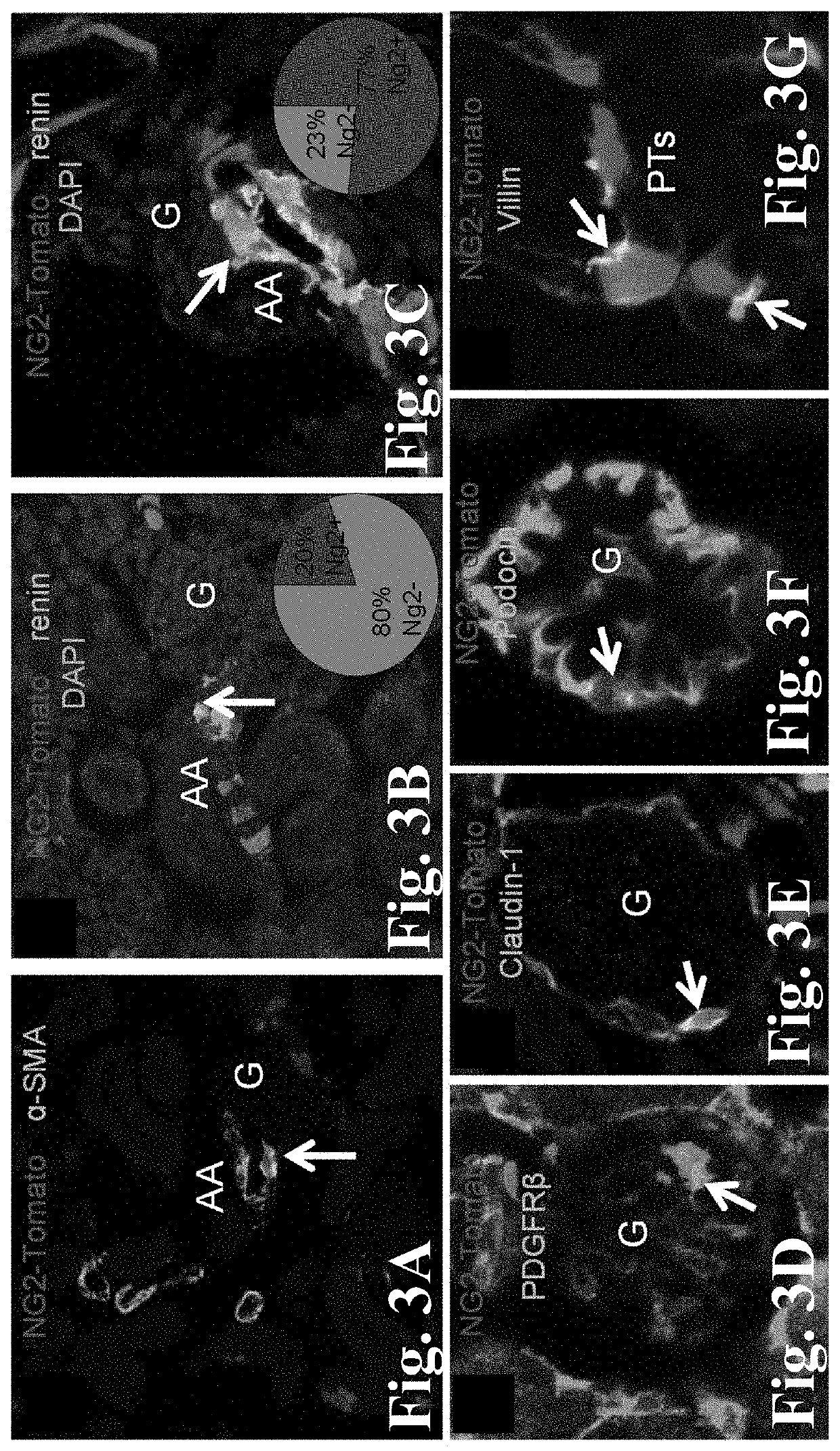 Targeting macula densa cells as a new therapeutic approach for kidney disease