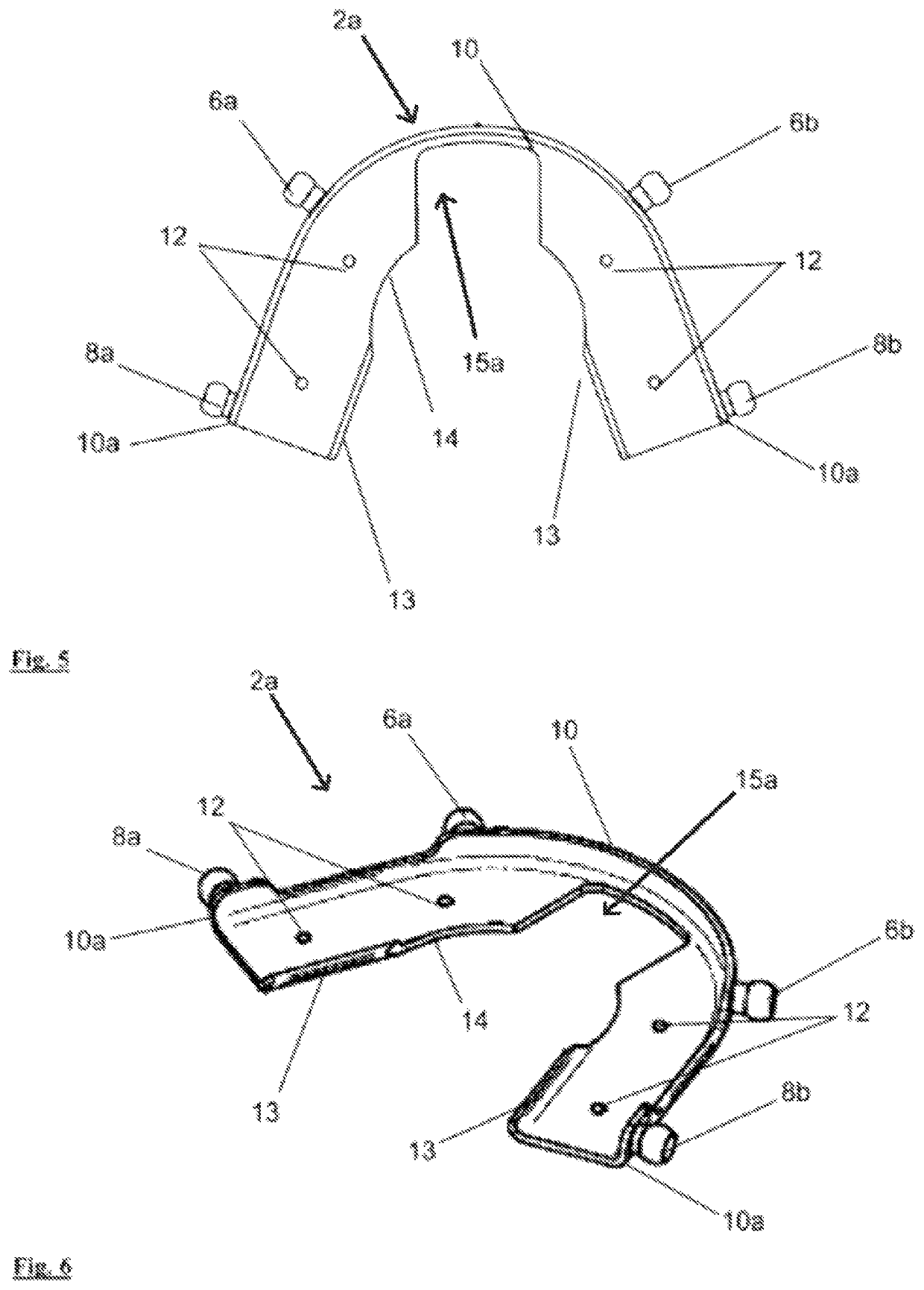 Two-part mandibular advancement splint