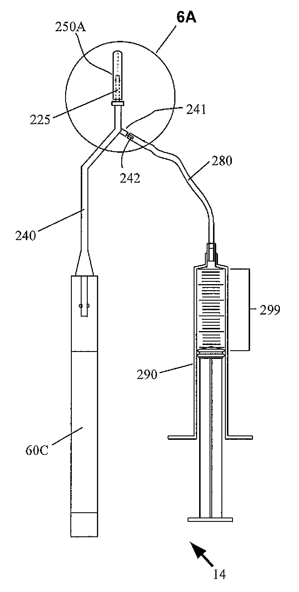 Apparatus and method for sinus lift procedure