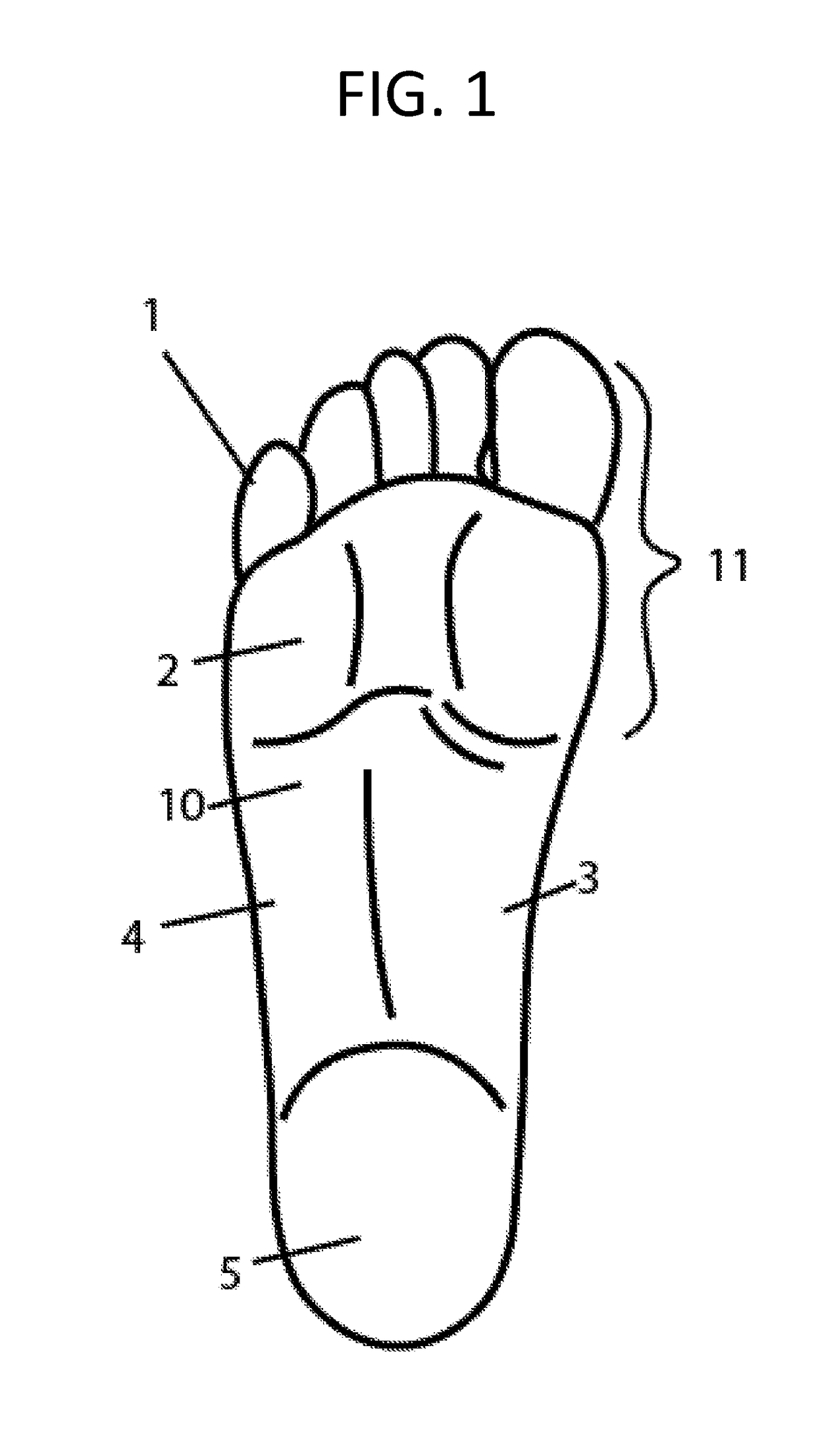 Modified Shoe Permitting Forefoot Extension For Natural Supination and Pronation