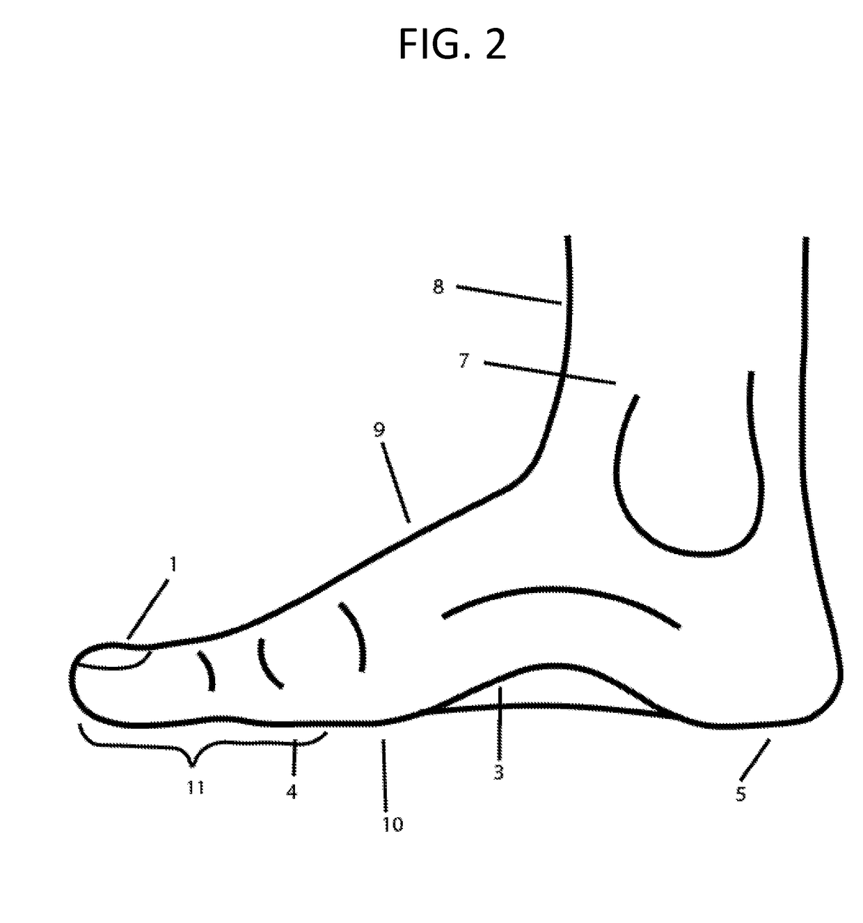 Modified Shoe Permitting Forefoot Extension For Natural Supination and Pronation