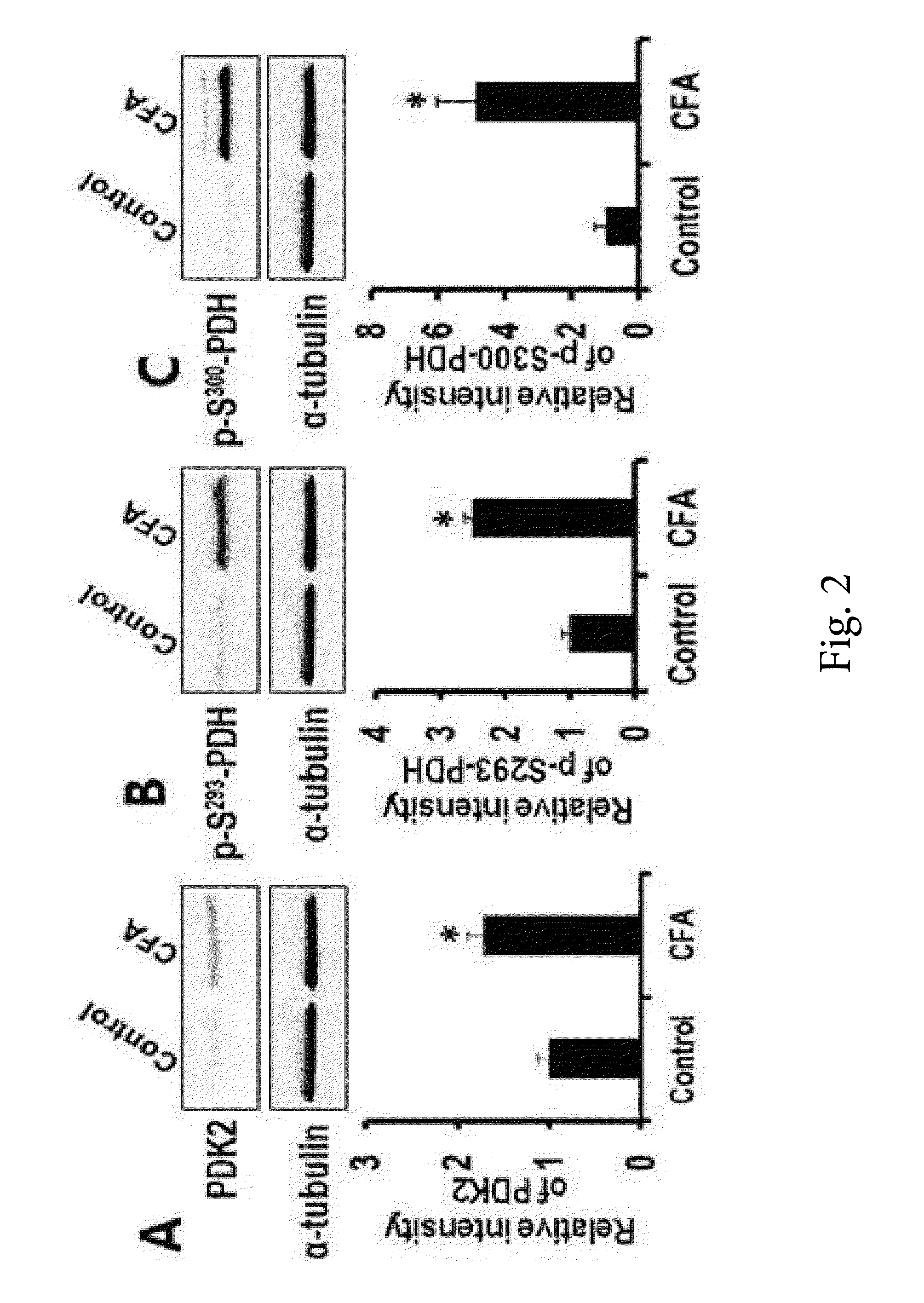 Composition containing pyruvate dehydrogenase kinase inhibitor for treating chronic inflammatory pain