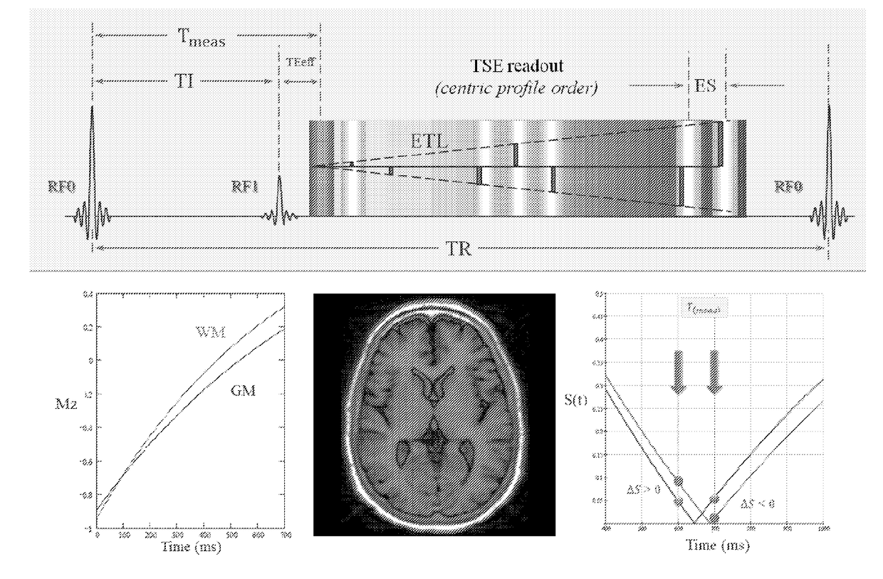 Aqueous contrast agents for dynamic MRI and mra