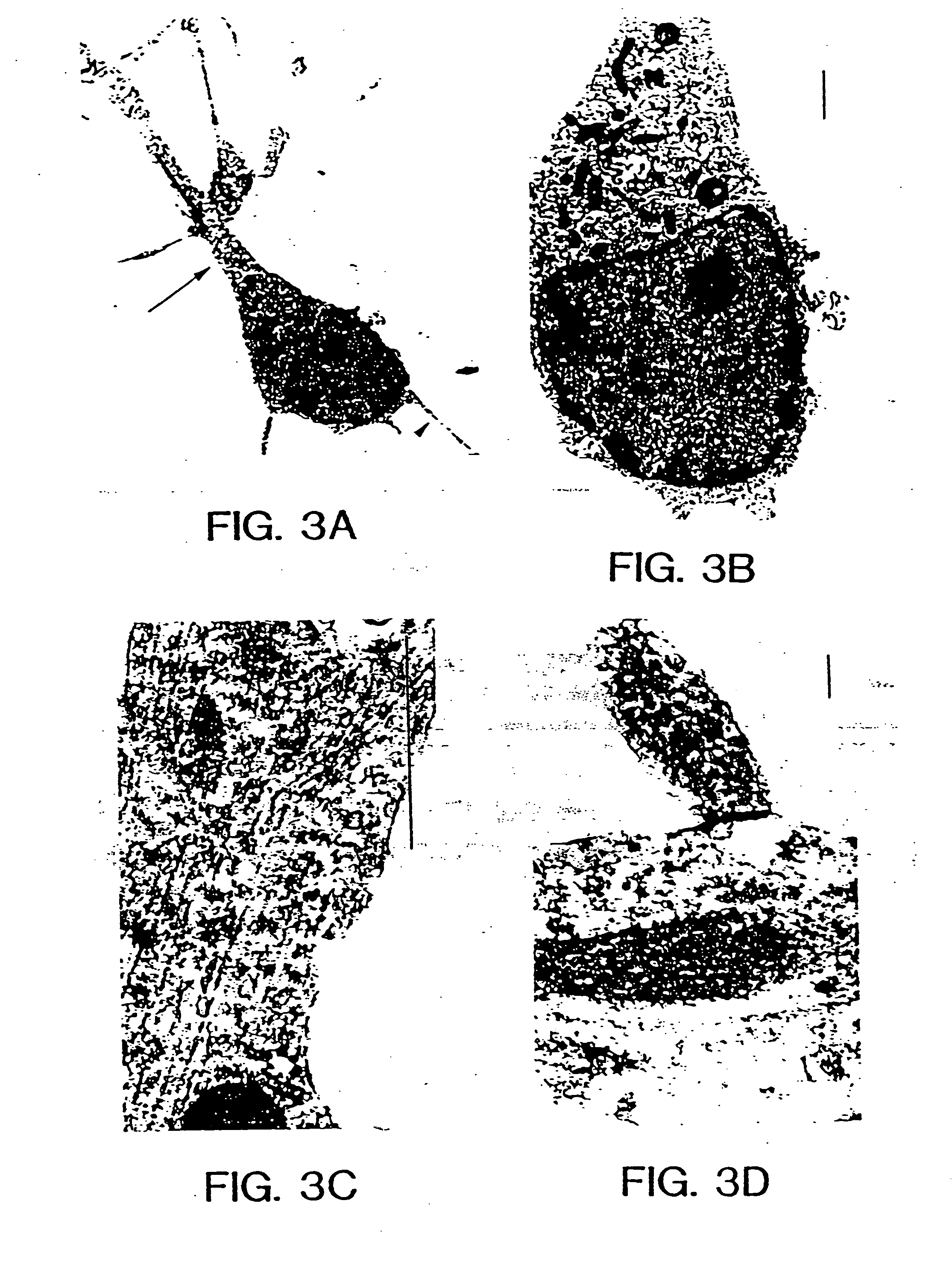 Method for production of neuroblasts