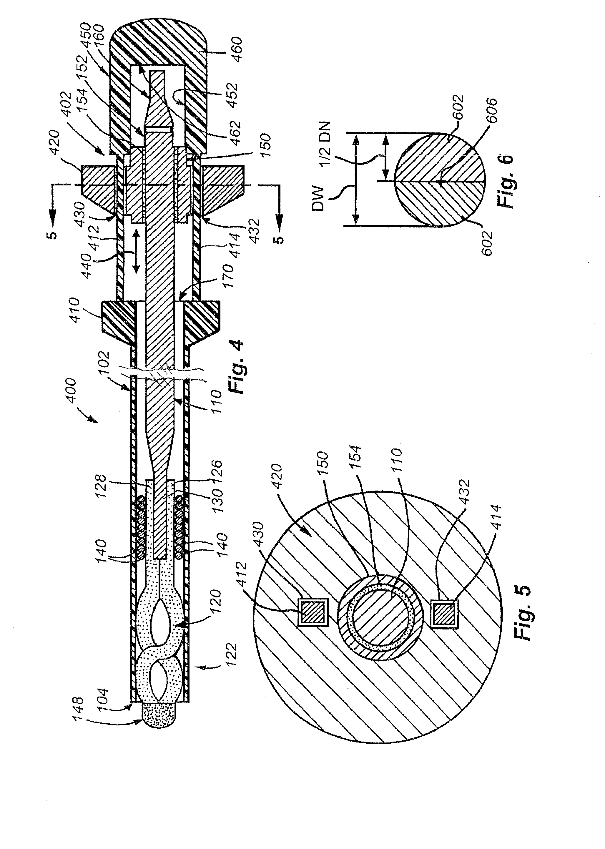 System and method for removal of material from a blood vessel using a small diameter catheter