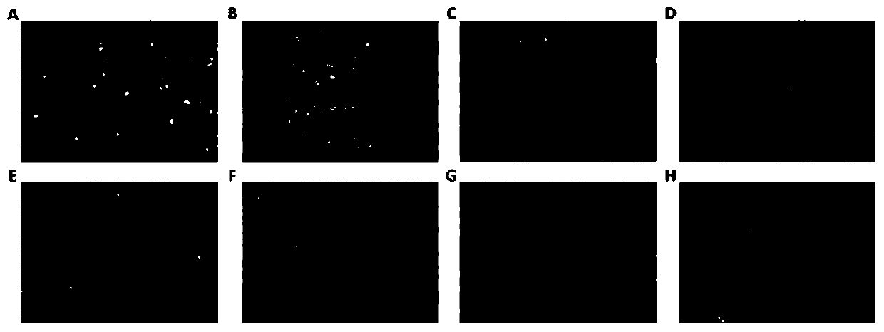 Application of ERK signal pathway small molecule inhibitor in inhibiting chlamydia infection