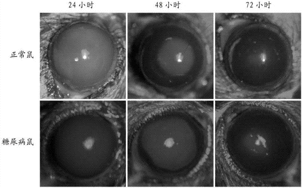 Application of manganese benzoate porphyrin in preparation of medicine for promoting diabetic corneal injury healing