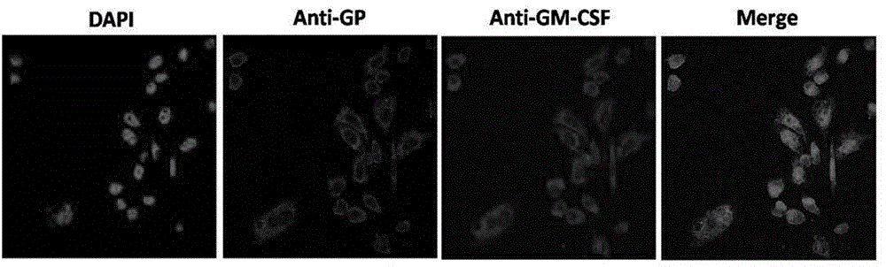 Hantaan virus-like particle containing GM-CSF as well as preparation method and application of hantaan virus-like particle