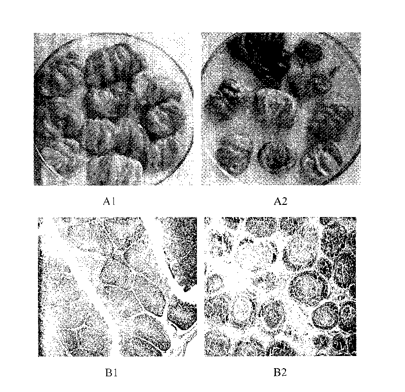Concentrated freeze-dried yolk antibody composite preparation for infectious bursal disease and preparation process thereof