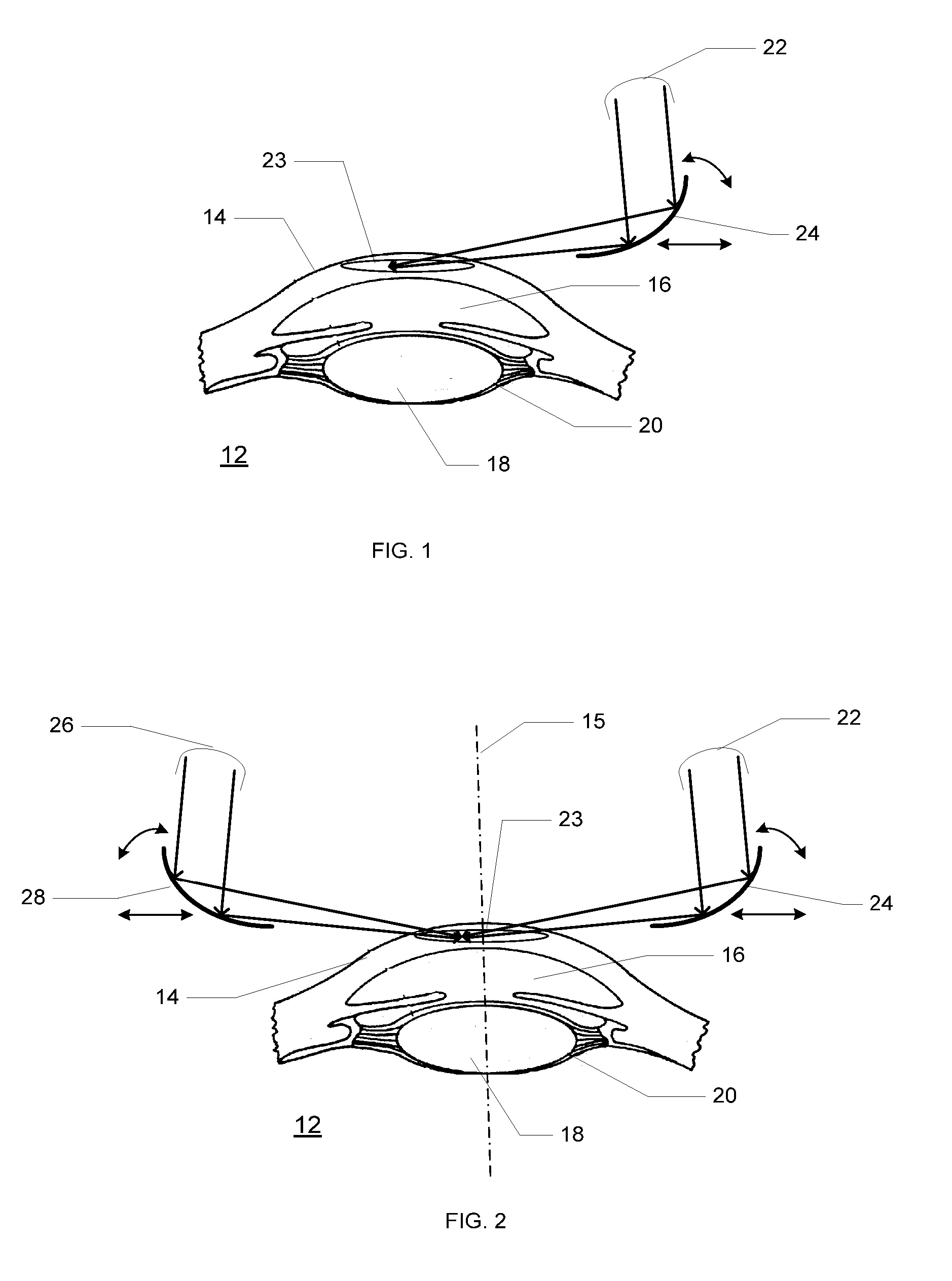 Method and Device for Cornea Reshaping by Intrastromal Tissue Removal