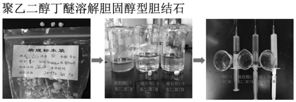 Novel litholytic agent