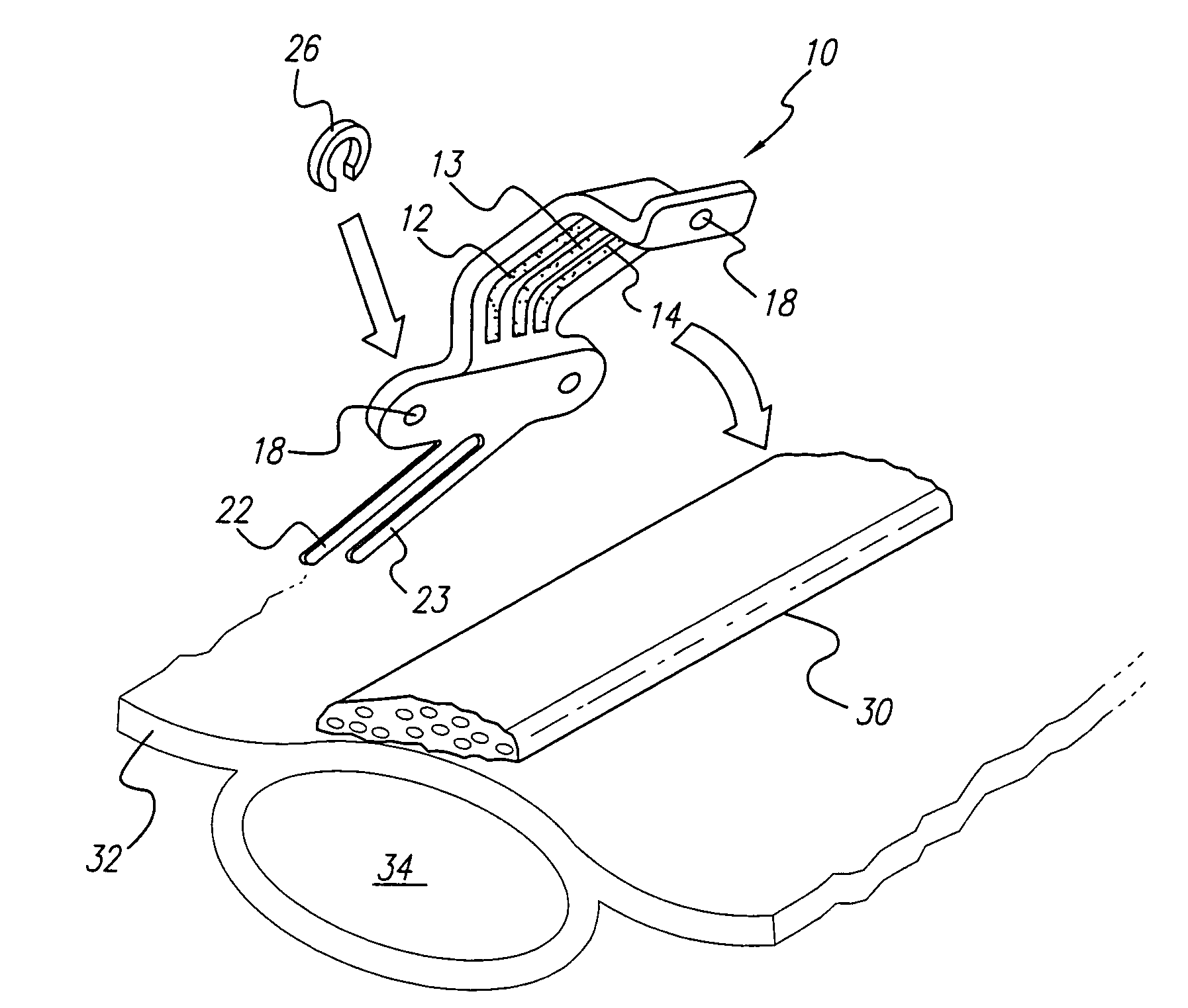 Curved paddle electrode for use with a neurostimulator