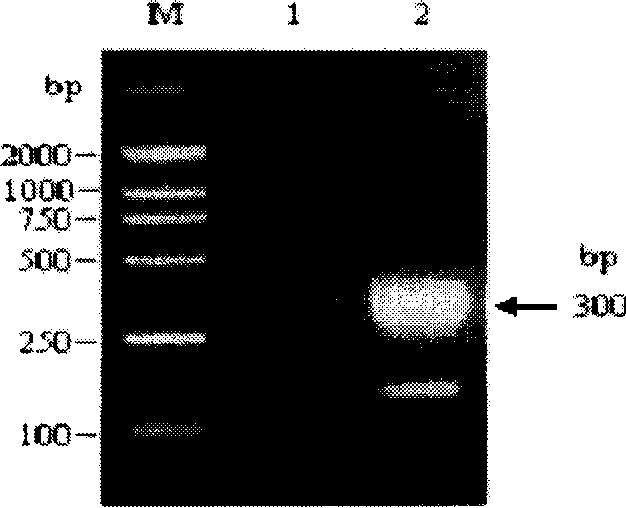 Novel antibacterial peptide and preparation method and use thereof