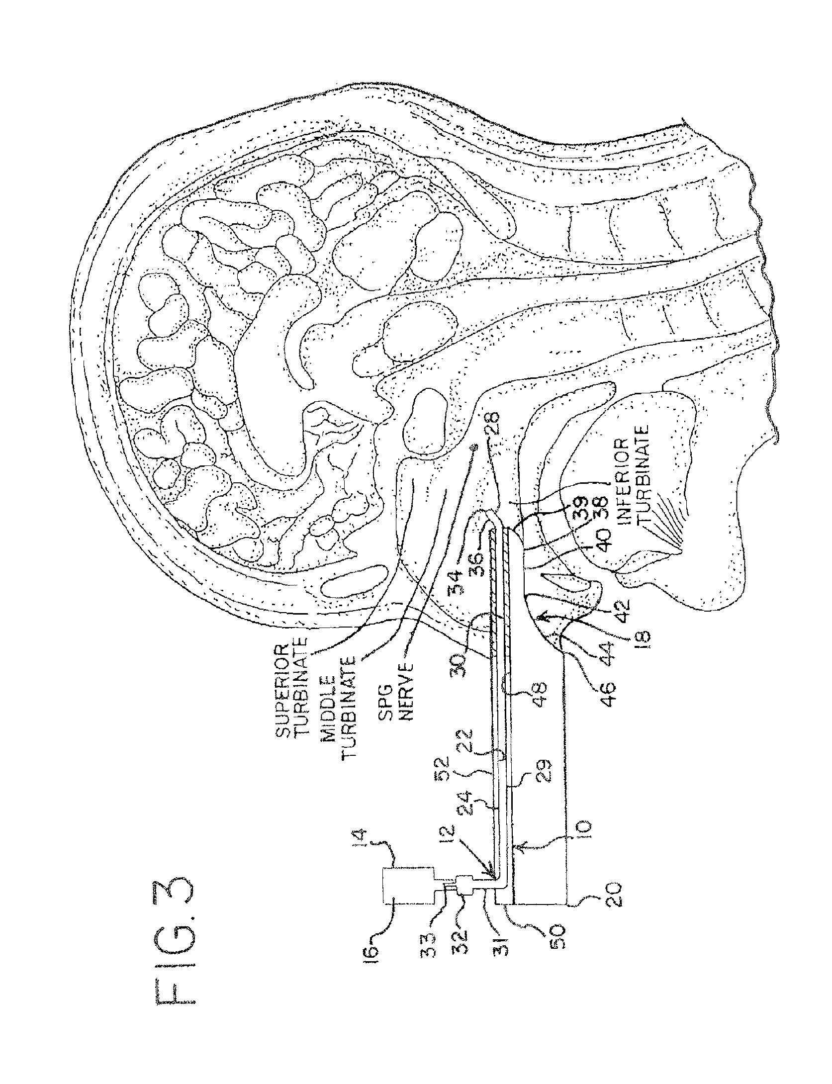 Devices for Delivering a Medicament and Connector for Same