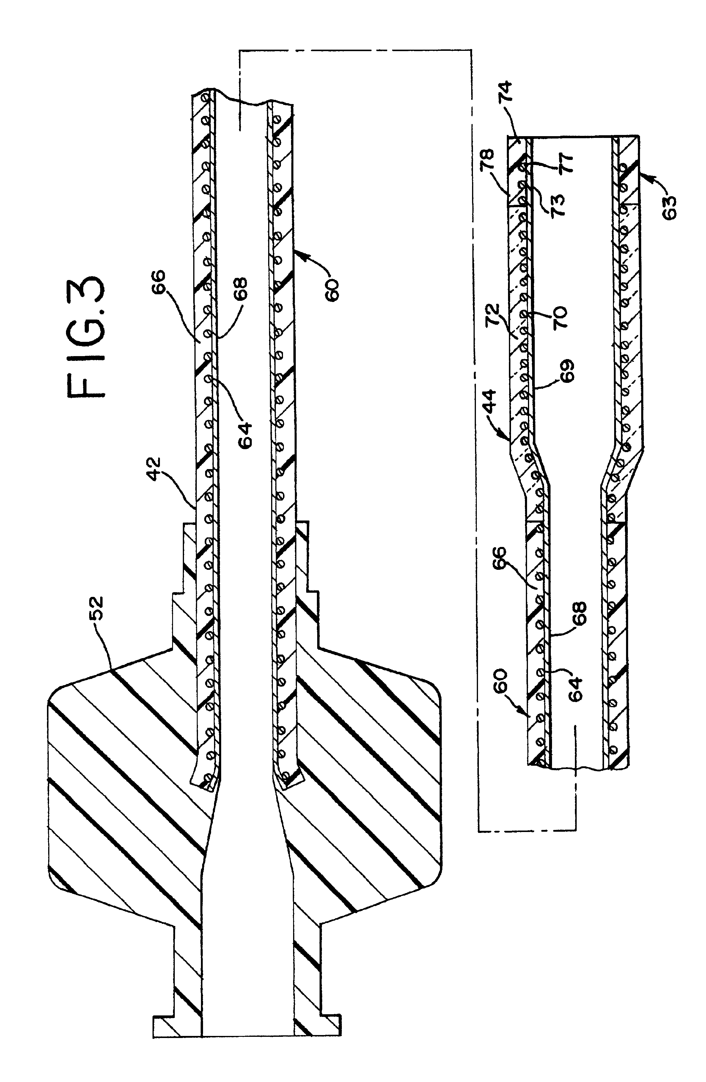 Stent delivery system having delivery catheter member with a clear transition zone
