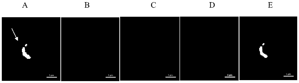 Enrichment detection method for epithelial-mesenchymal hybrid and PD-L1 positive circulating tumor cell