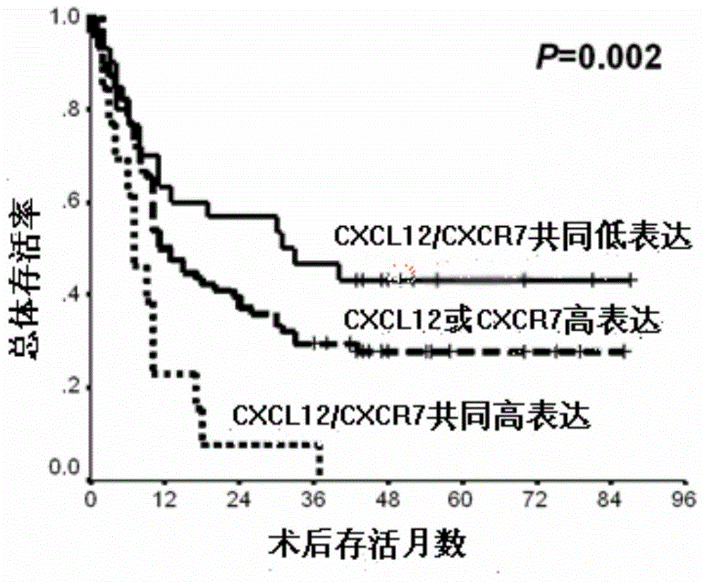 Kit for predicting pancreatic cancer patient prognosis adverse risks and application thereof