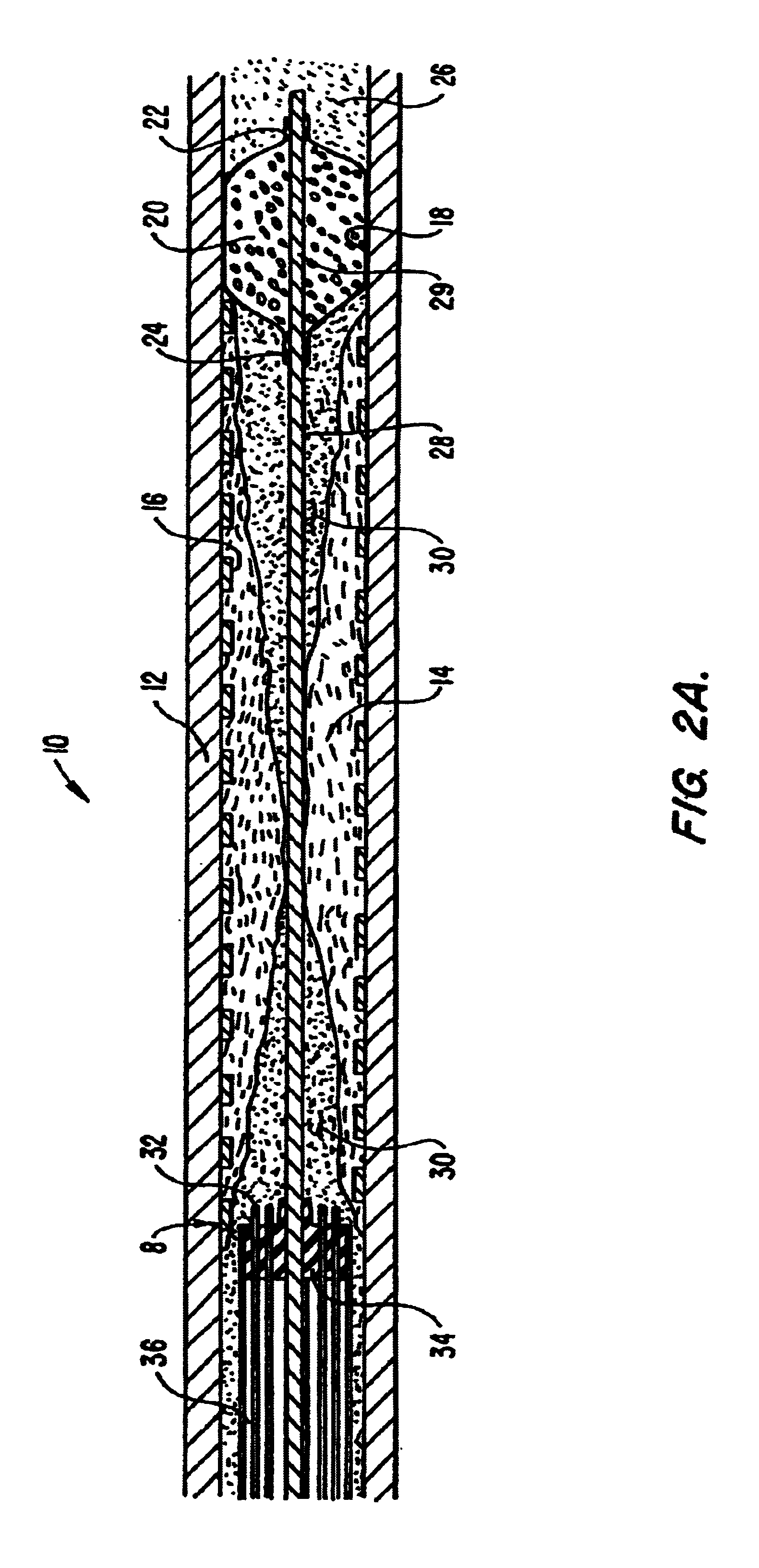 Electrosurgical systems and methods for recanalization of occluded body lumens