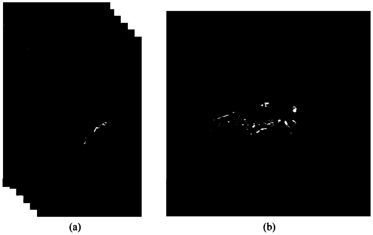 BMO position positioning method of OCT image