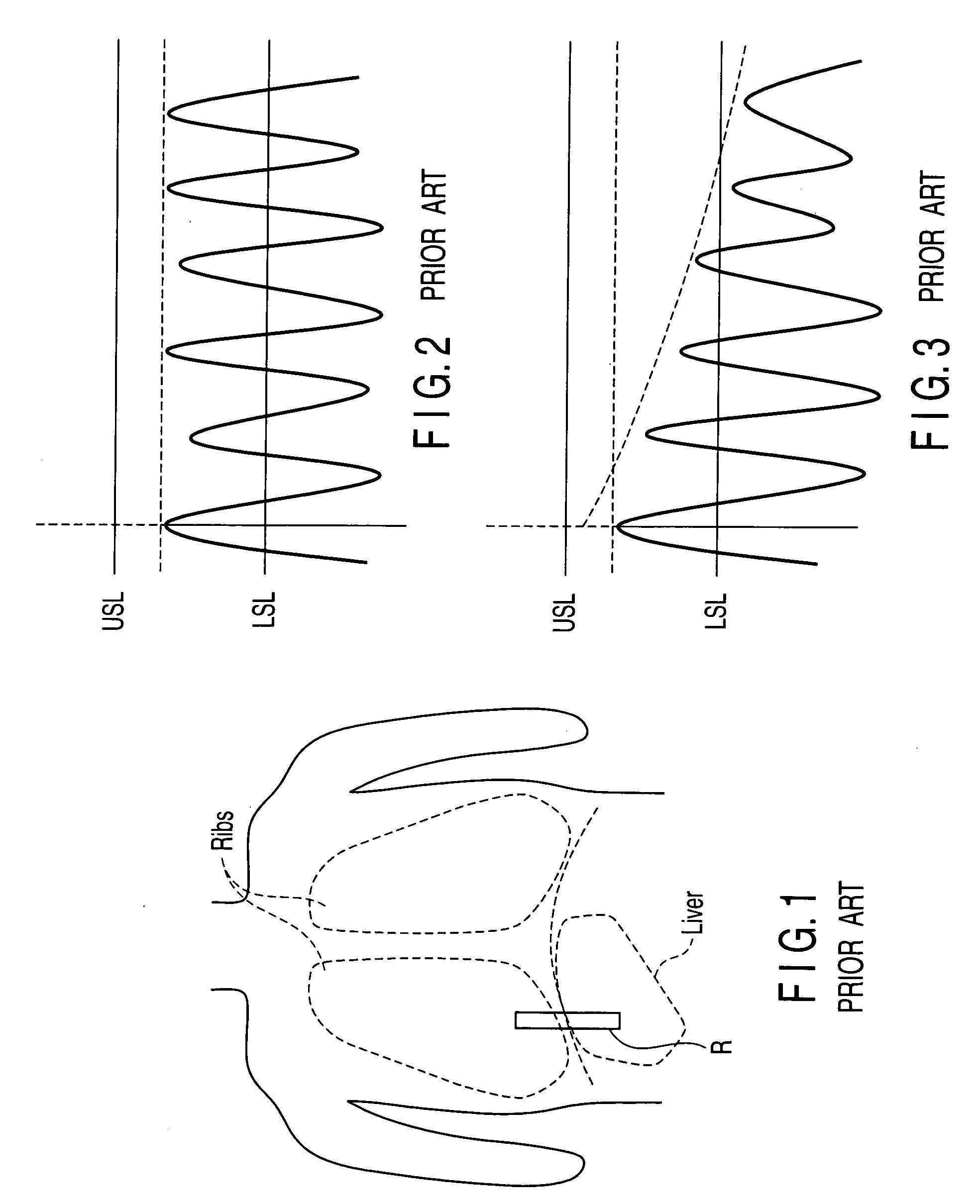 Magnetic resonance imaging apparatus and control method thereof
