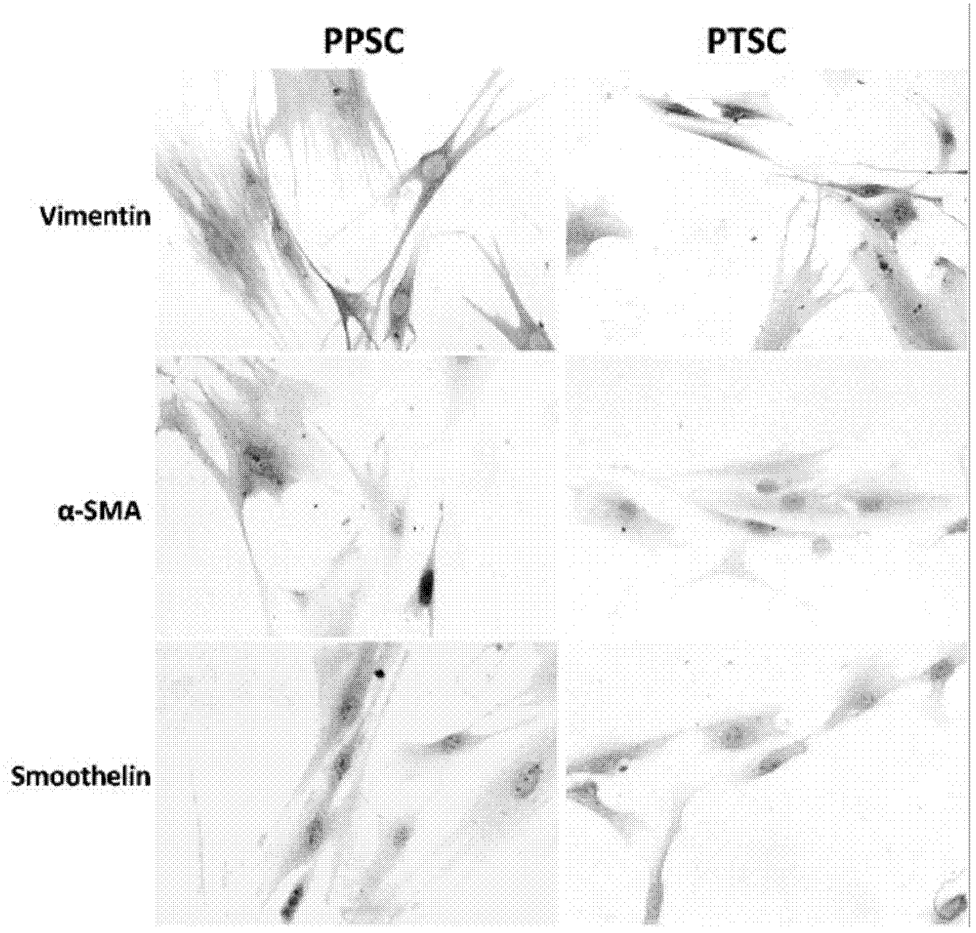 Tumor model capable of reflecting prostatic cancer to generate zone functional difference and establishment method