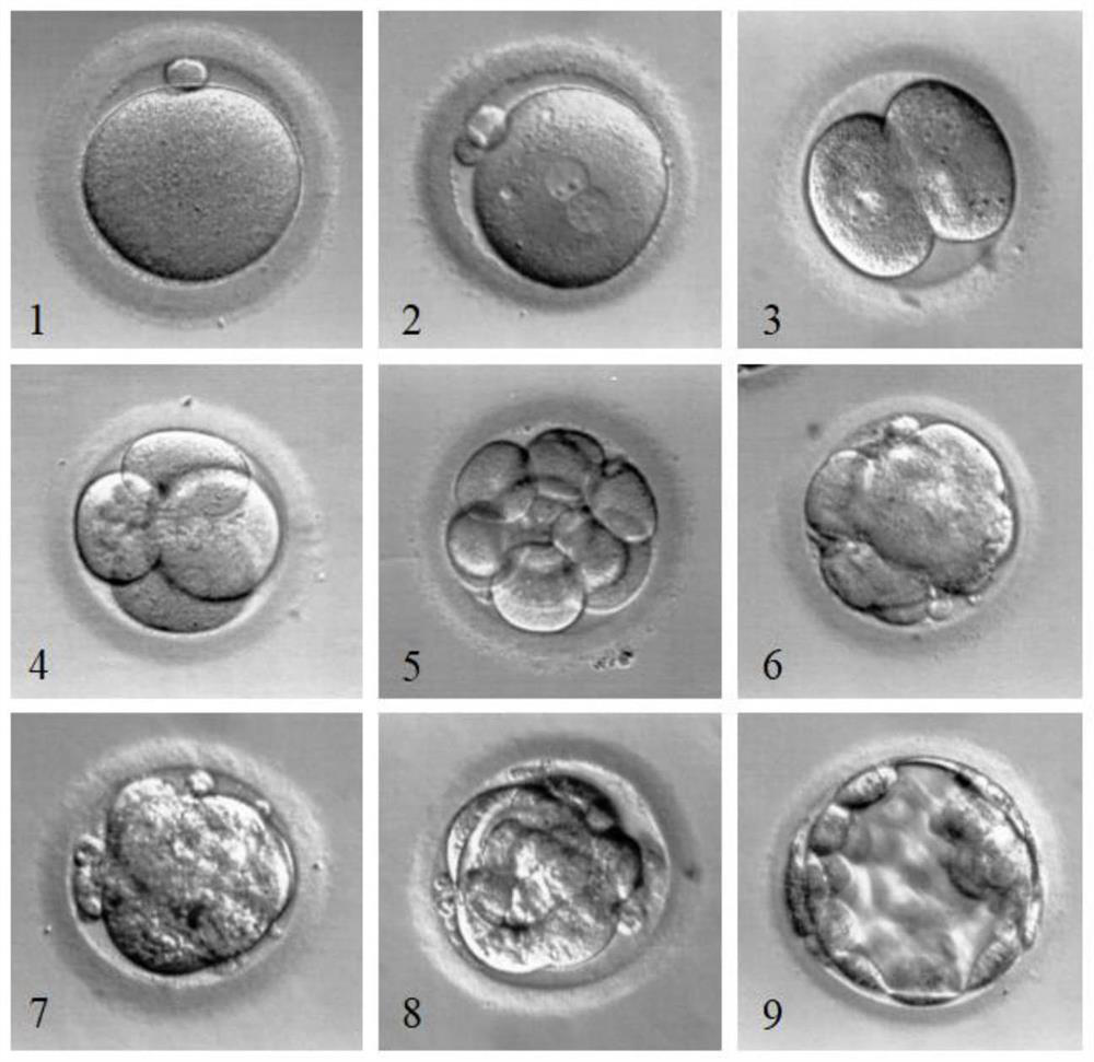 Human oocyte in-vitro pre-fertilization culture method, series of culture solutions and application