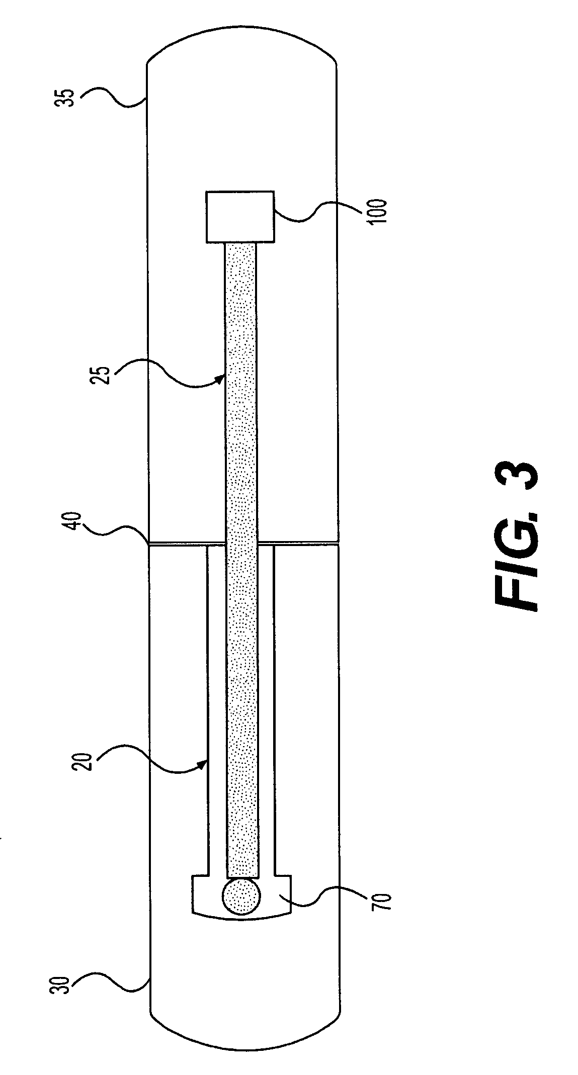 Device and method for tendon, ligament or soft tissue repair