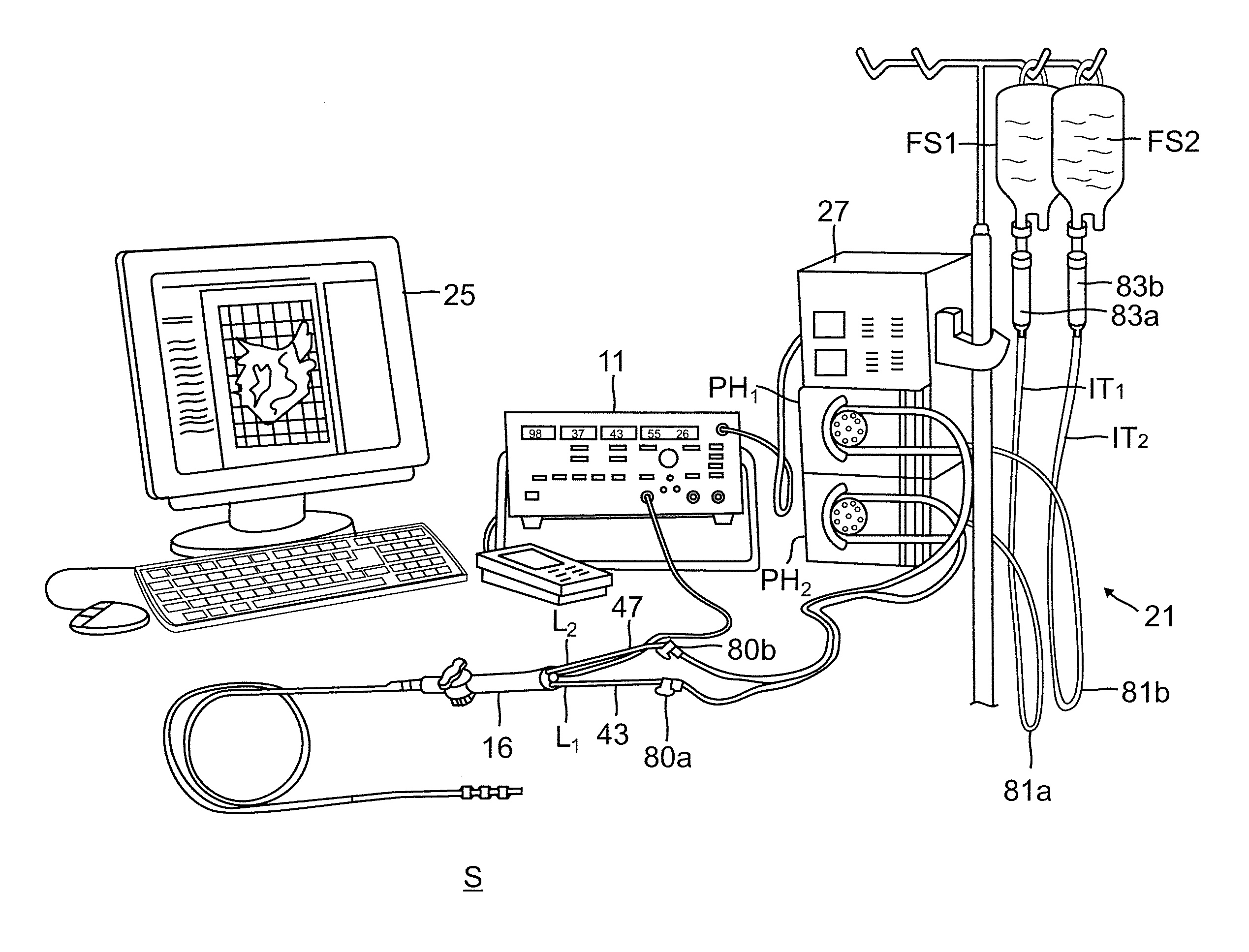 Integrated ablation system using catheter with multiple irrigation lumens