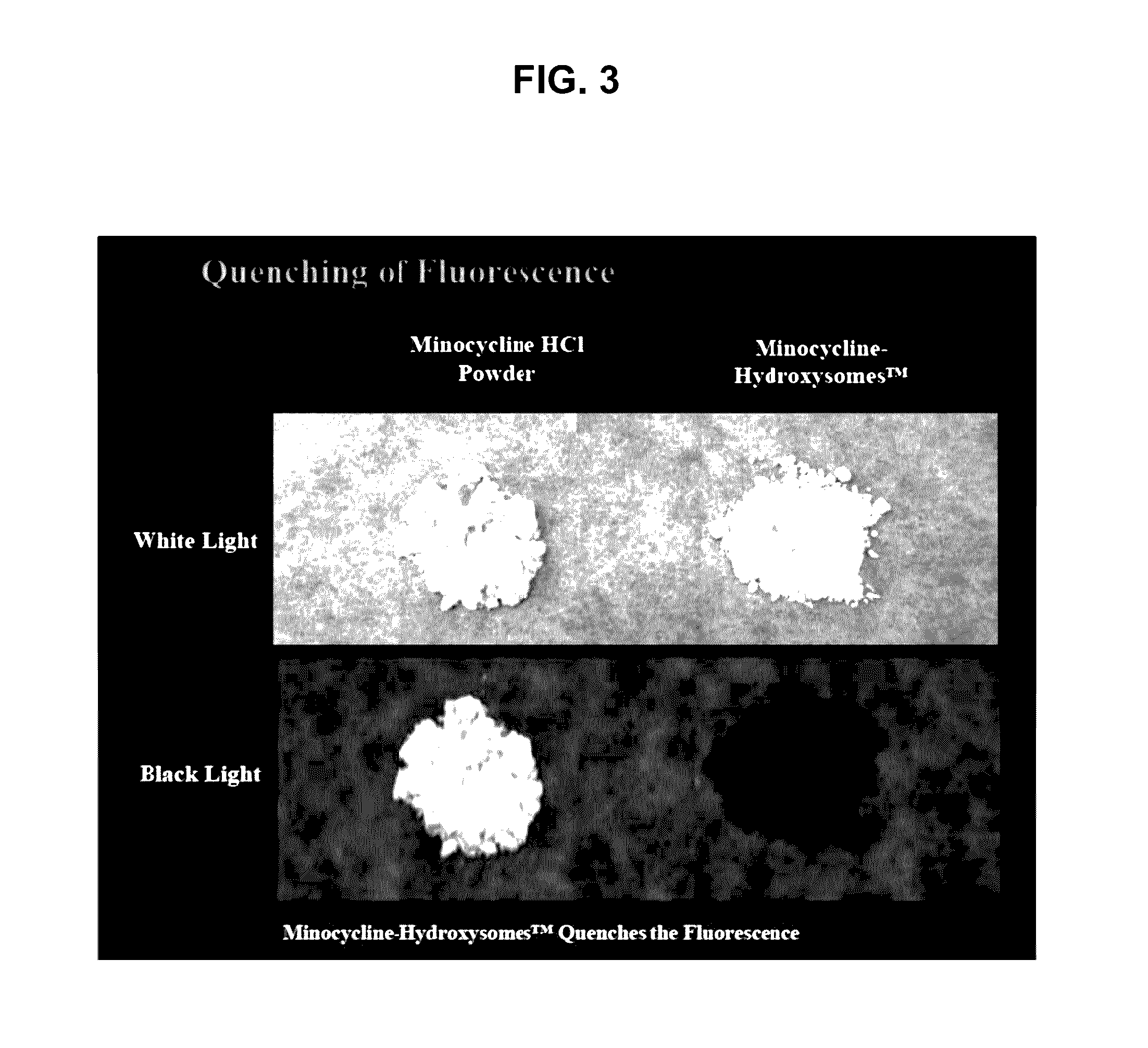 Topical minocycline compositions and methods of using the same