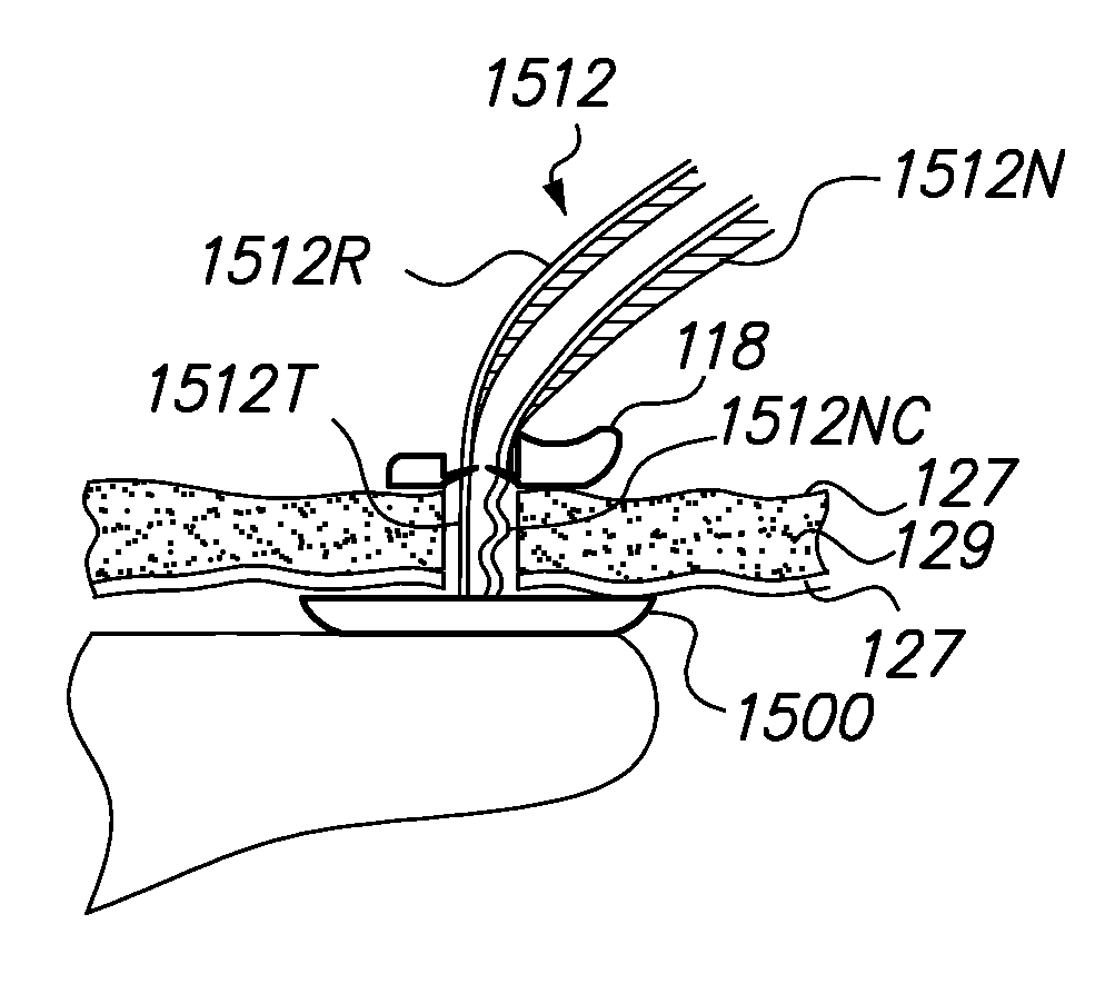 Port System and Methods