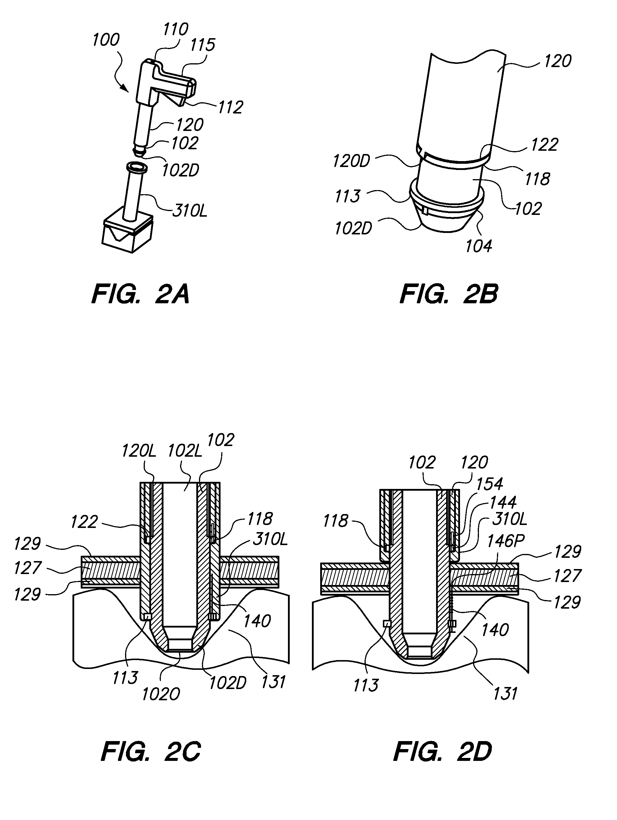 Port System and Methods