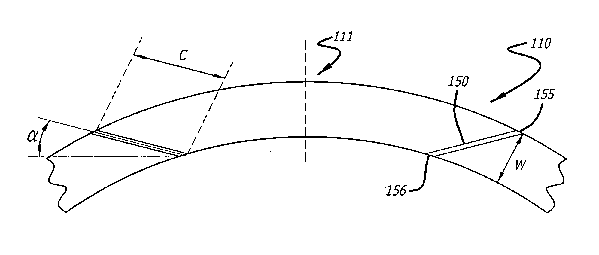 Intraocular lens with distortion free valve