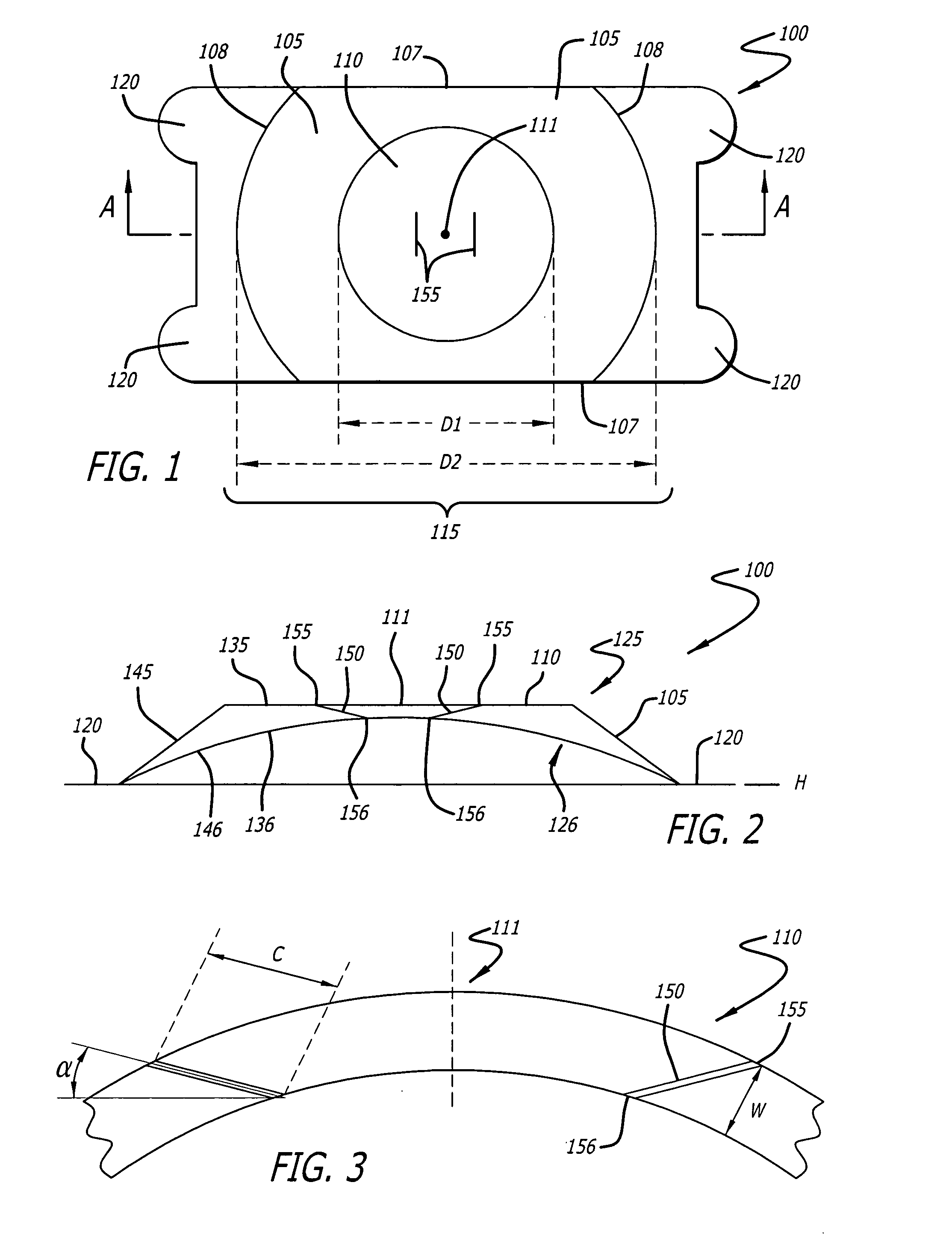 Intraocular lens with distortion free valve