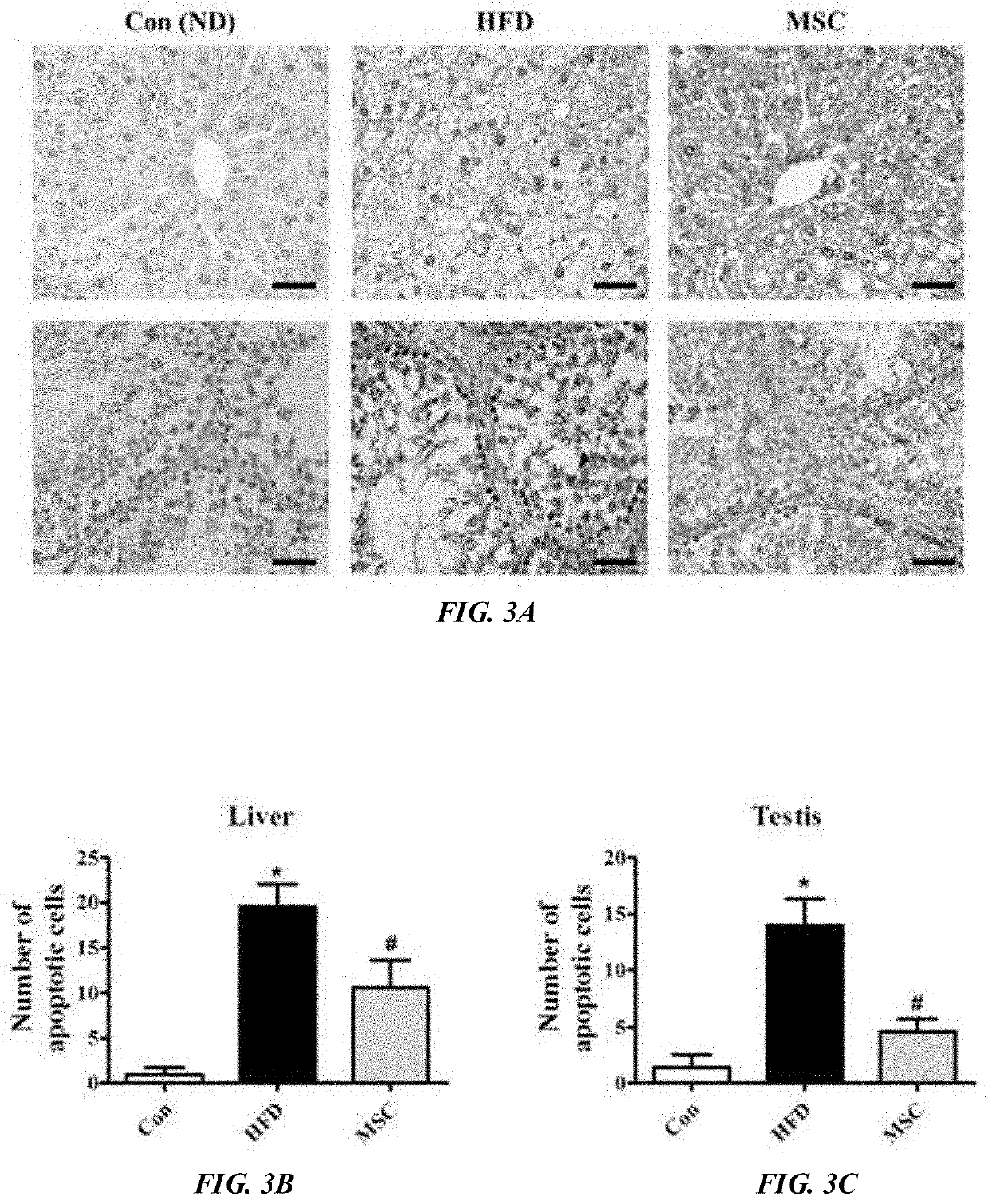 Pharmaceutical composition comprising periodontal tissue-derived pluripotent stem cells for prevention or treatment of male infertility