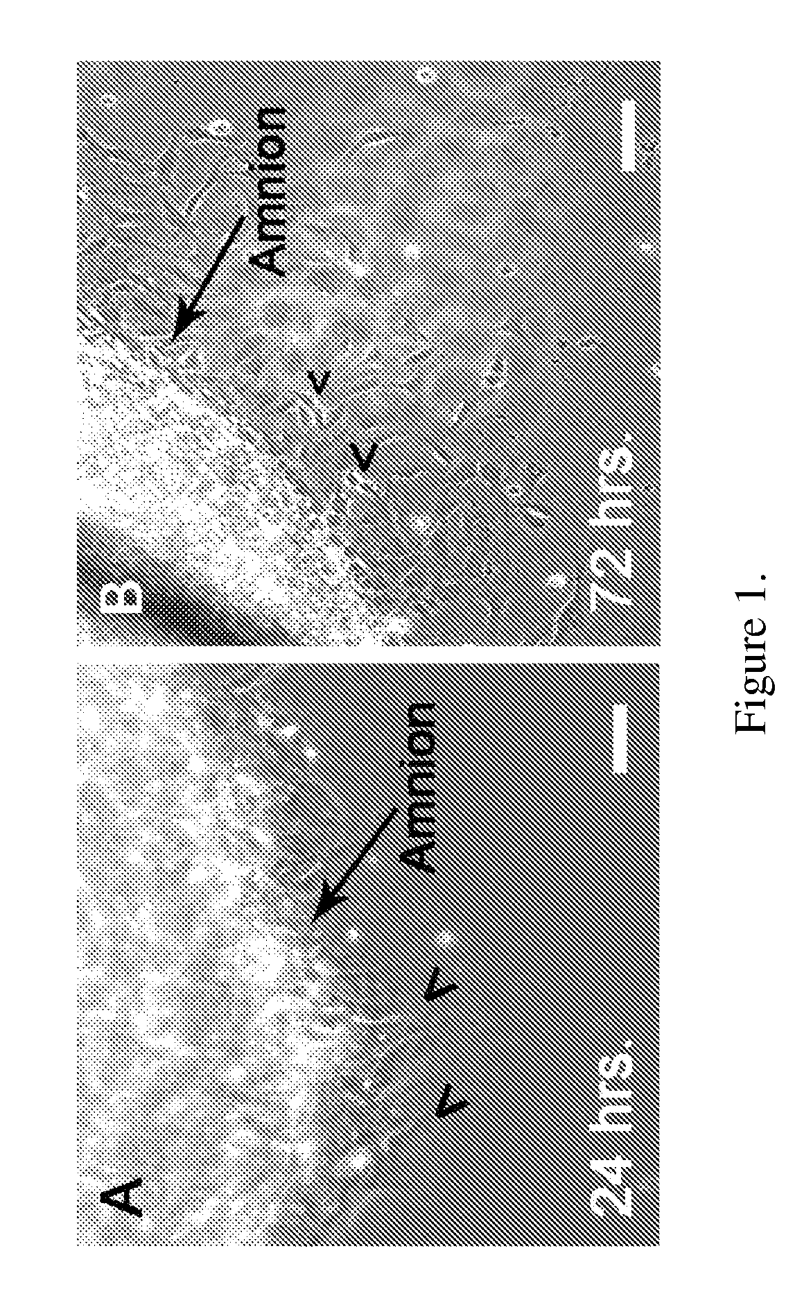 Amnion-derived stem cells and uses thereof