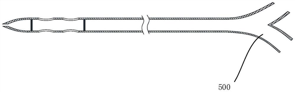 Suction catheter with side hole and device