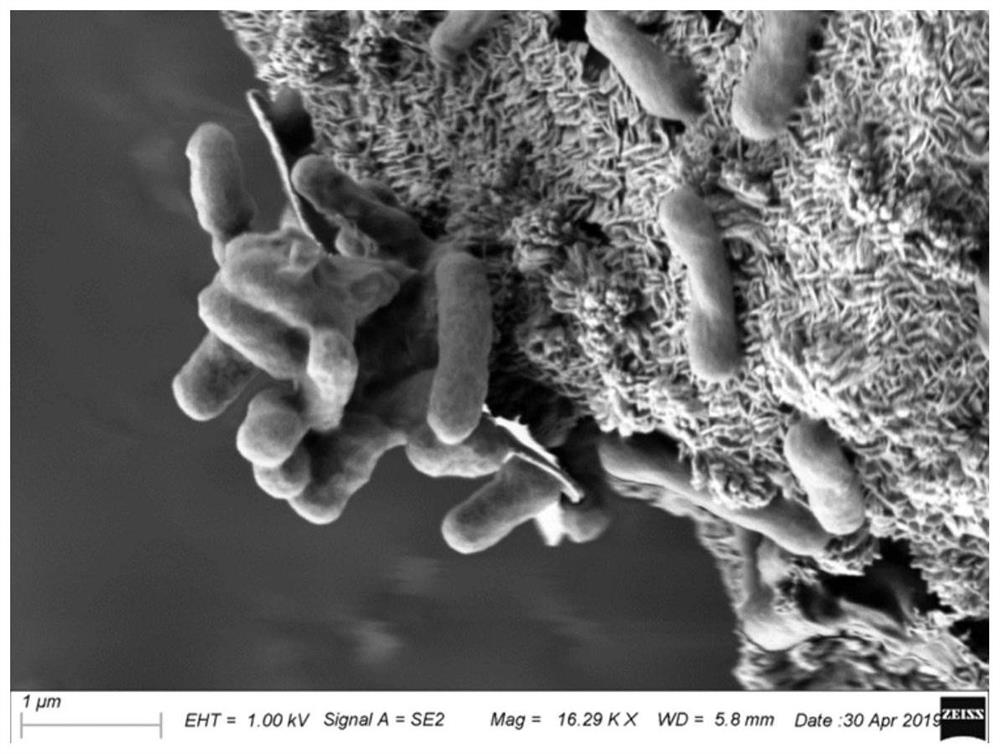 Salt-tolerant arthrobacter and nitrogen fixation application thereof