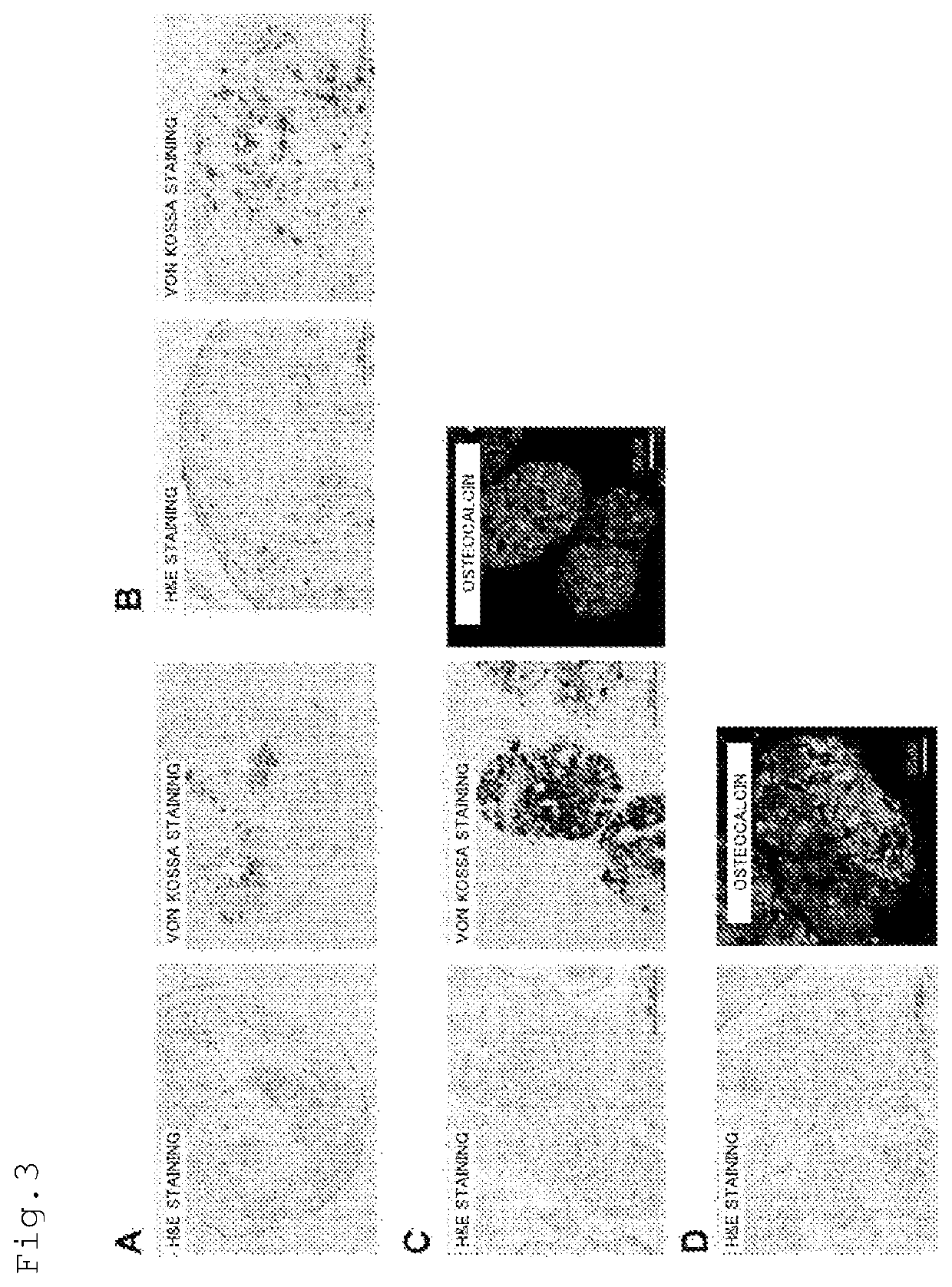 Method for producing osteoblast cluster using human iPS cells