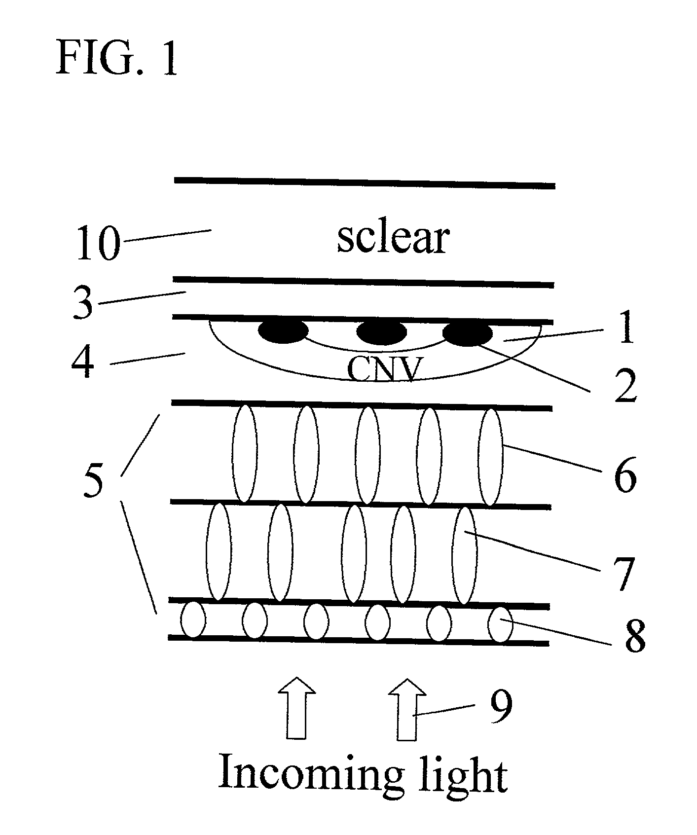Apparatus and methods for prevention of age-related macular degeneration and other eye diseases