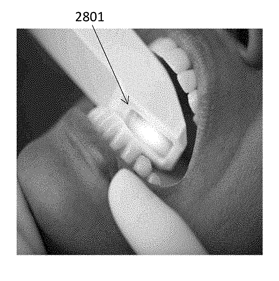 Methods and apparatuses for forming a three-dimensional volumetric model of a subject's teeth
