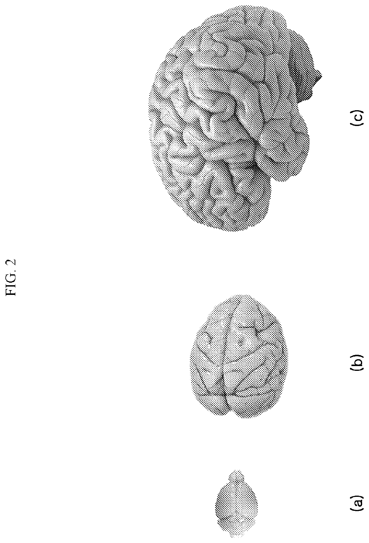 Neurotransmitter-based brain mapping method and use of brain map