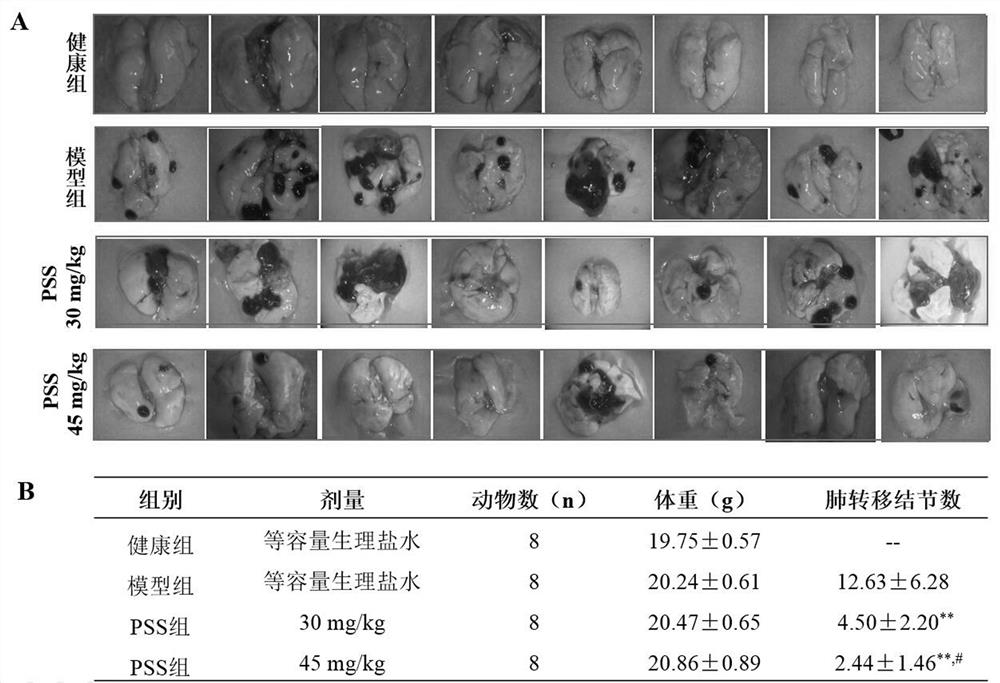 Application of sodium alginate diester in the preparation of drugs for preventing or treating tumor metastasis