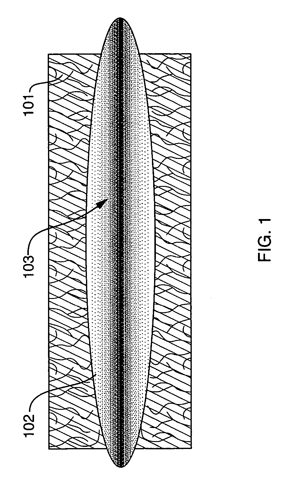 Controlled absorption biograft material for autologous tissue support