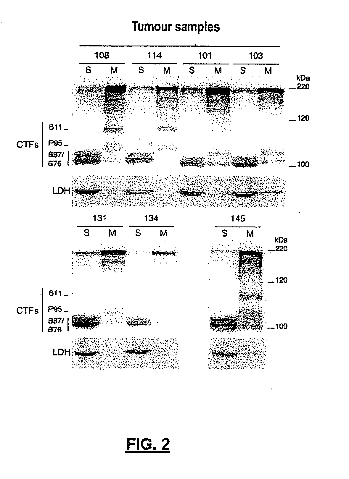 Method for Diagnosing Cancers Expressing the HER2 Receptor or its Truncated Variants