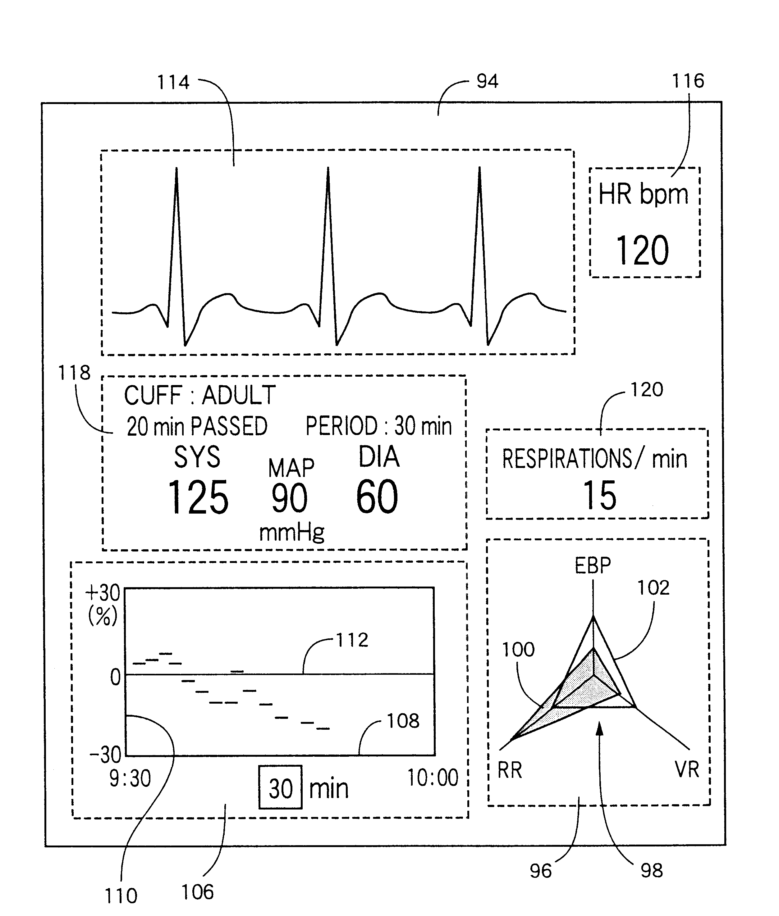 Blood-pressure monitor apparatus