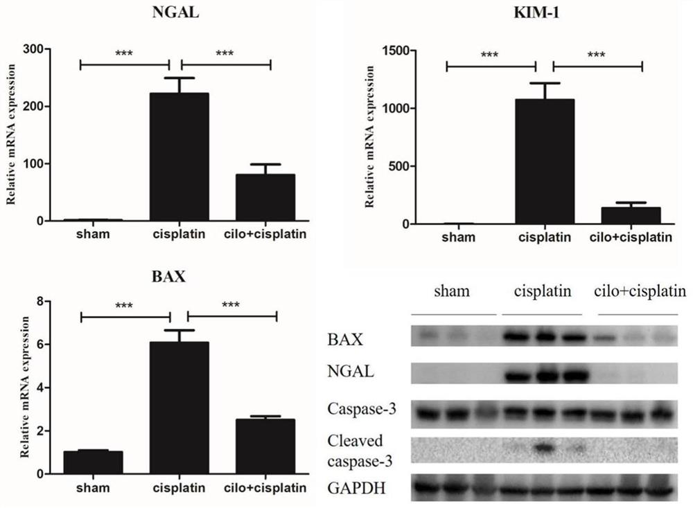 Use of cilomilast in the preparation of medicines for the treatment of acute kidney injury related diseases