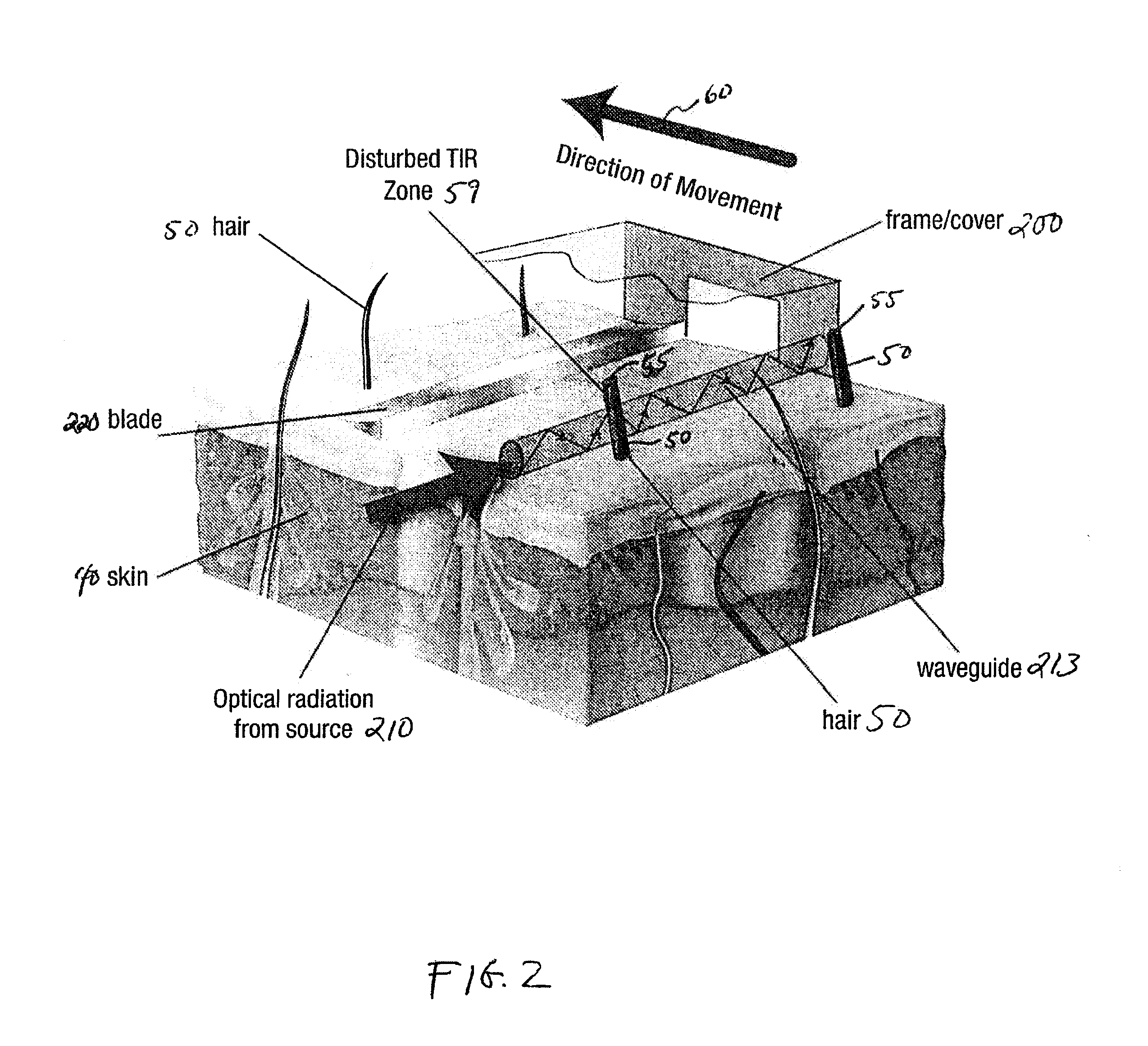 Combination of shaver and opto-thermal modification of hair