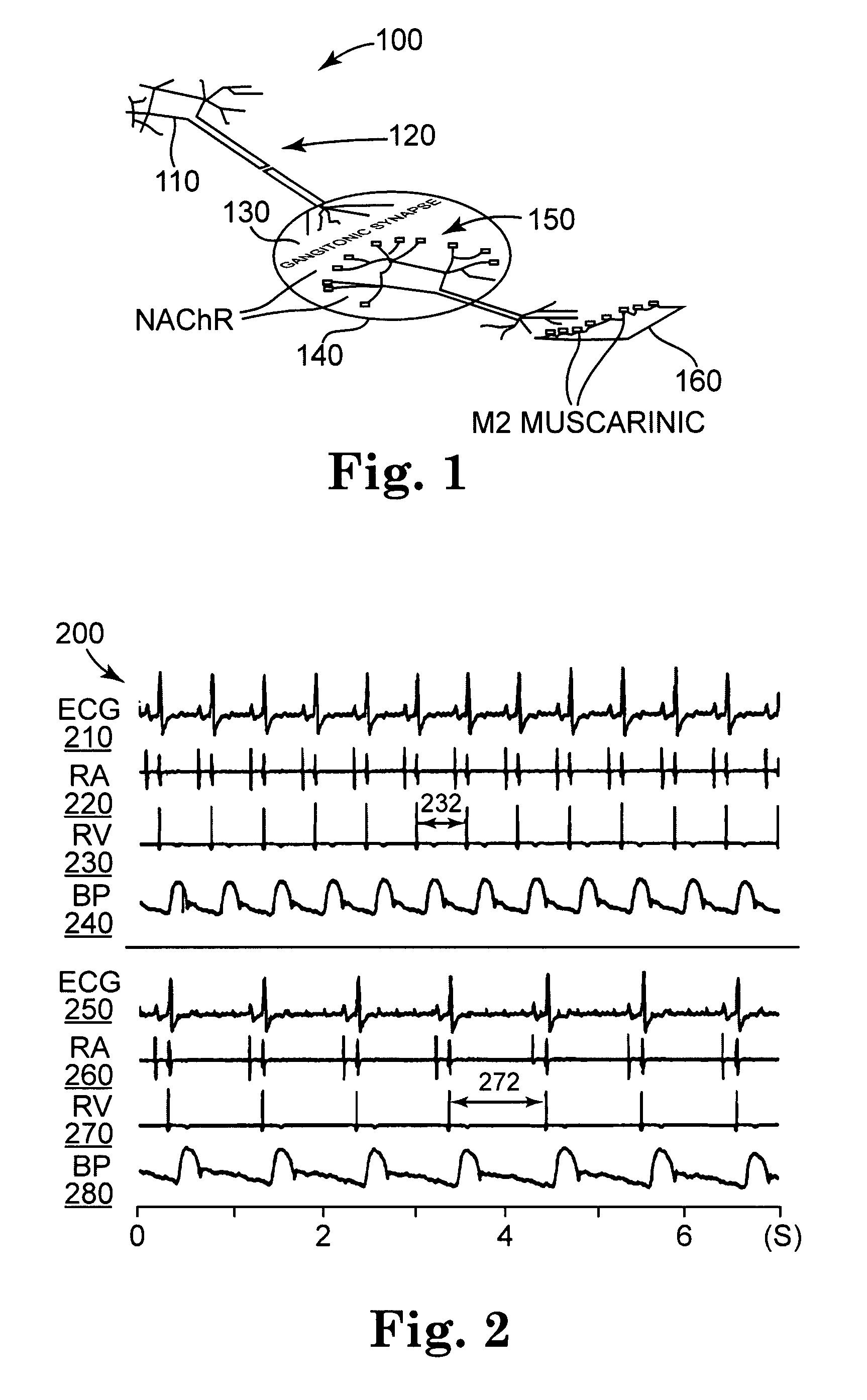 Treatment of cardiac arrhythmia by modification of neuronal signaling through fat pads of the heart