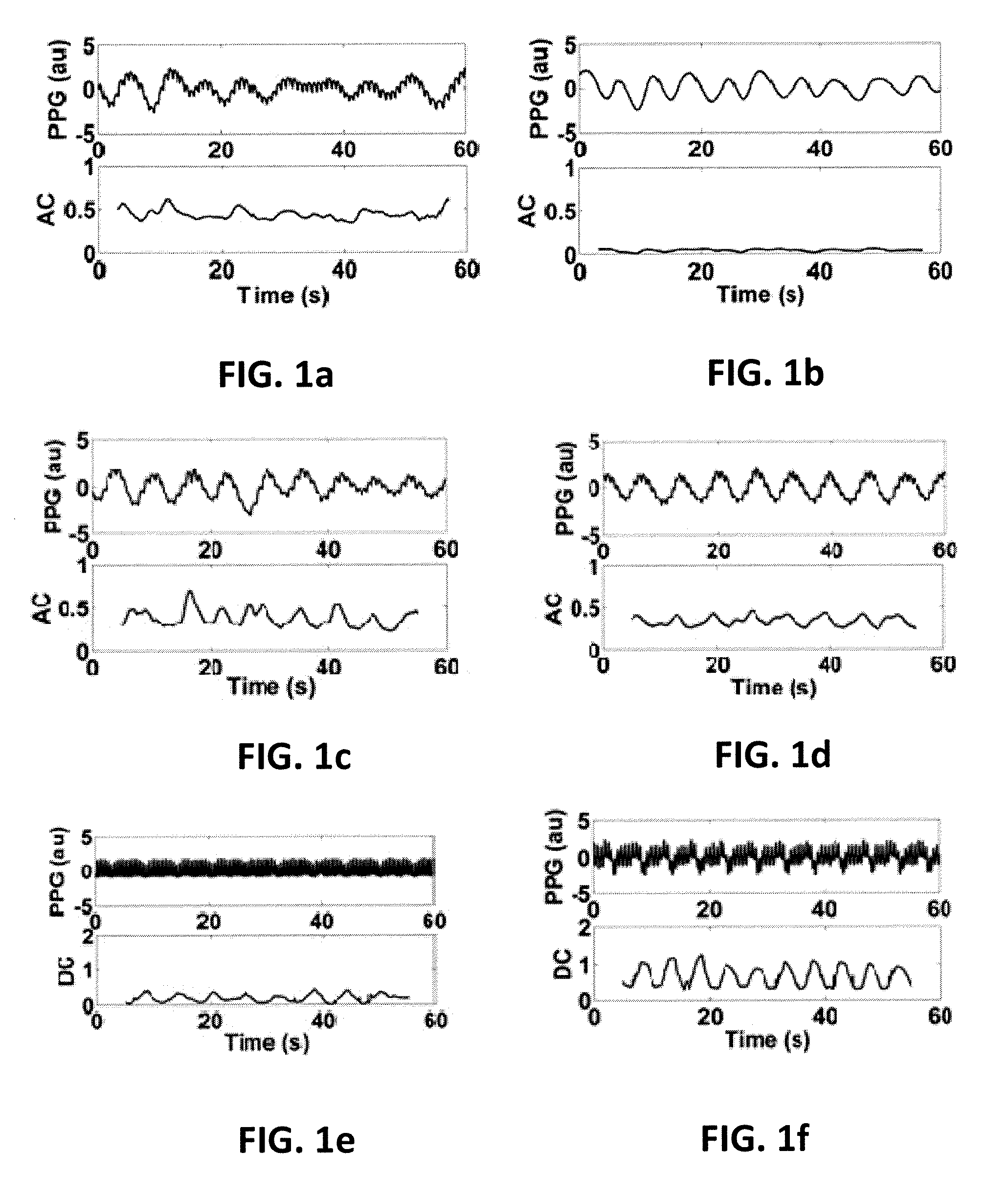 Apparatus and method for respiratory rate detection and early detection of blood loss volume