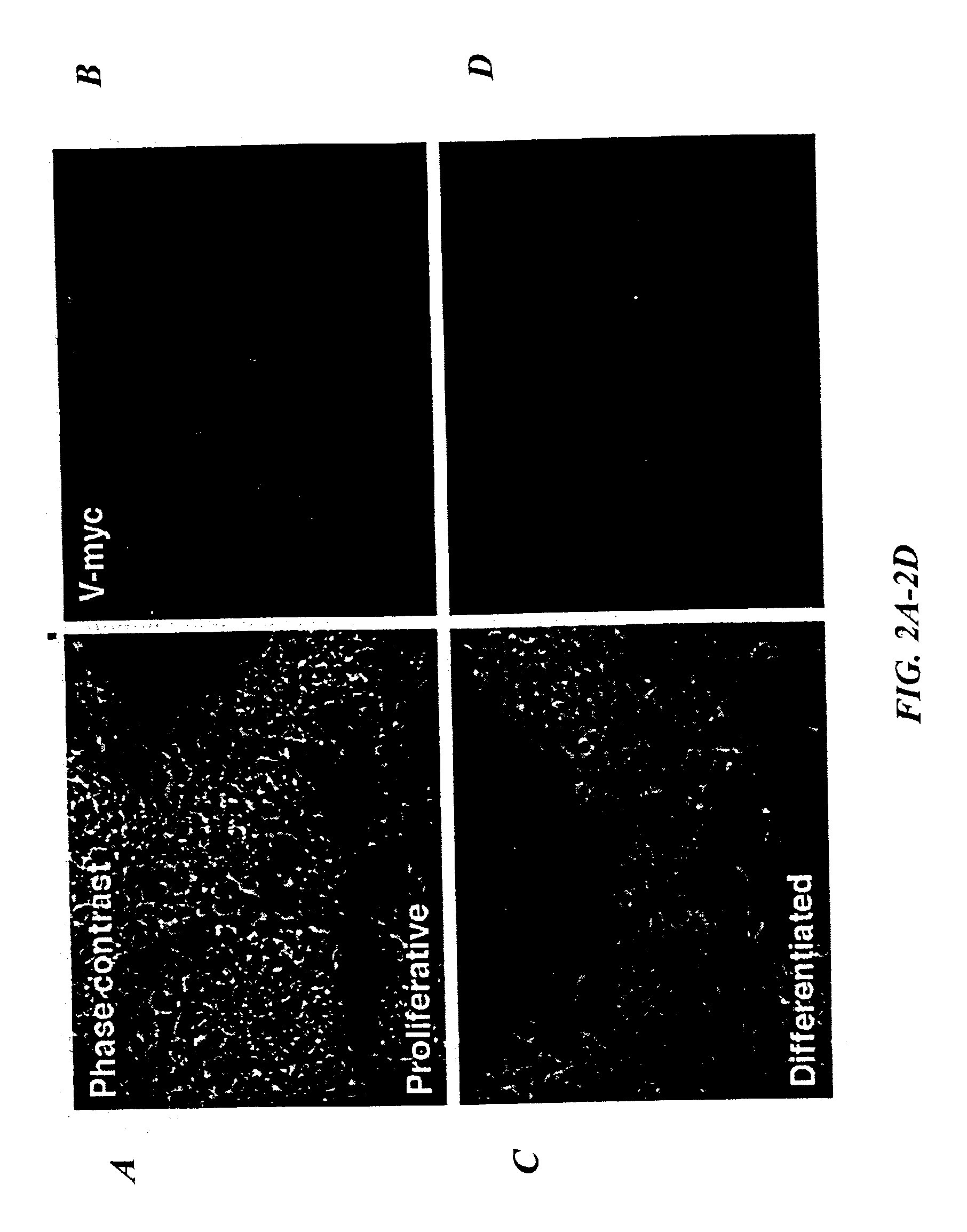 Human mesencephalon cell lines and methods of use therefor